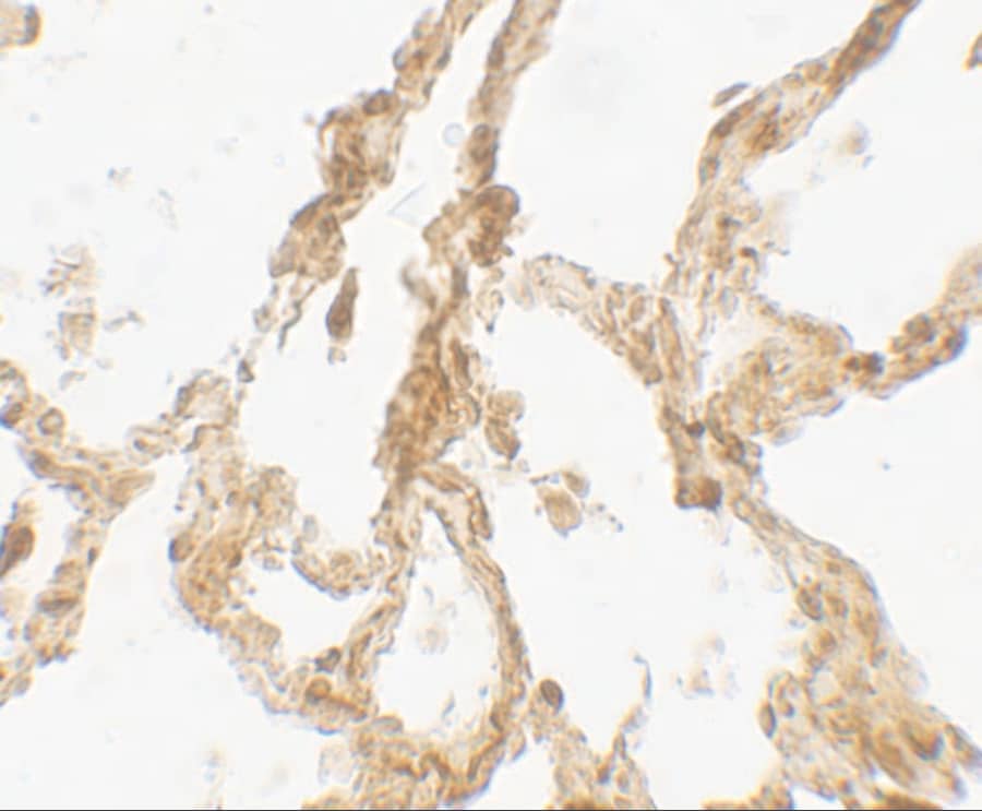 Immunohistochemistry TRPV4 Antibody - BSA Free