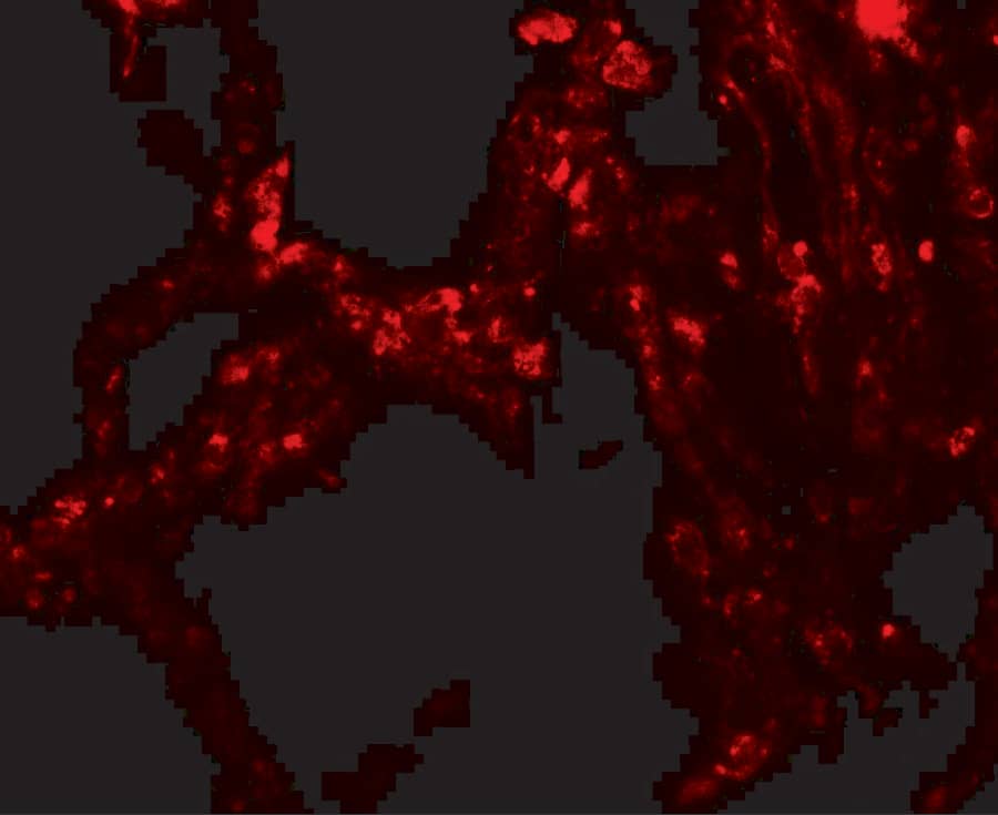 Immunocytochemistry/ Immunofluorescence: TRPV4 Antibody - BSA Free [NBP2-41262] - Immunofluorescence of TRPV4 in human lung tissue with TRPV4 antibody at 20 ug/mL.