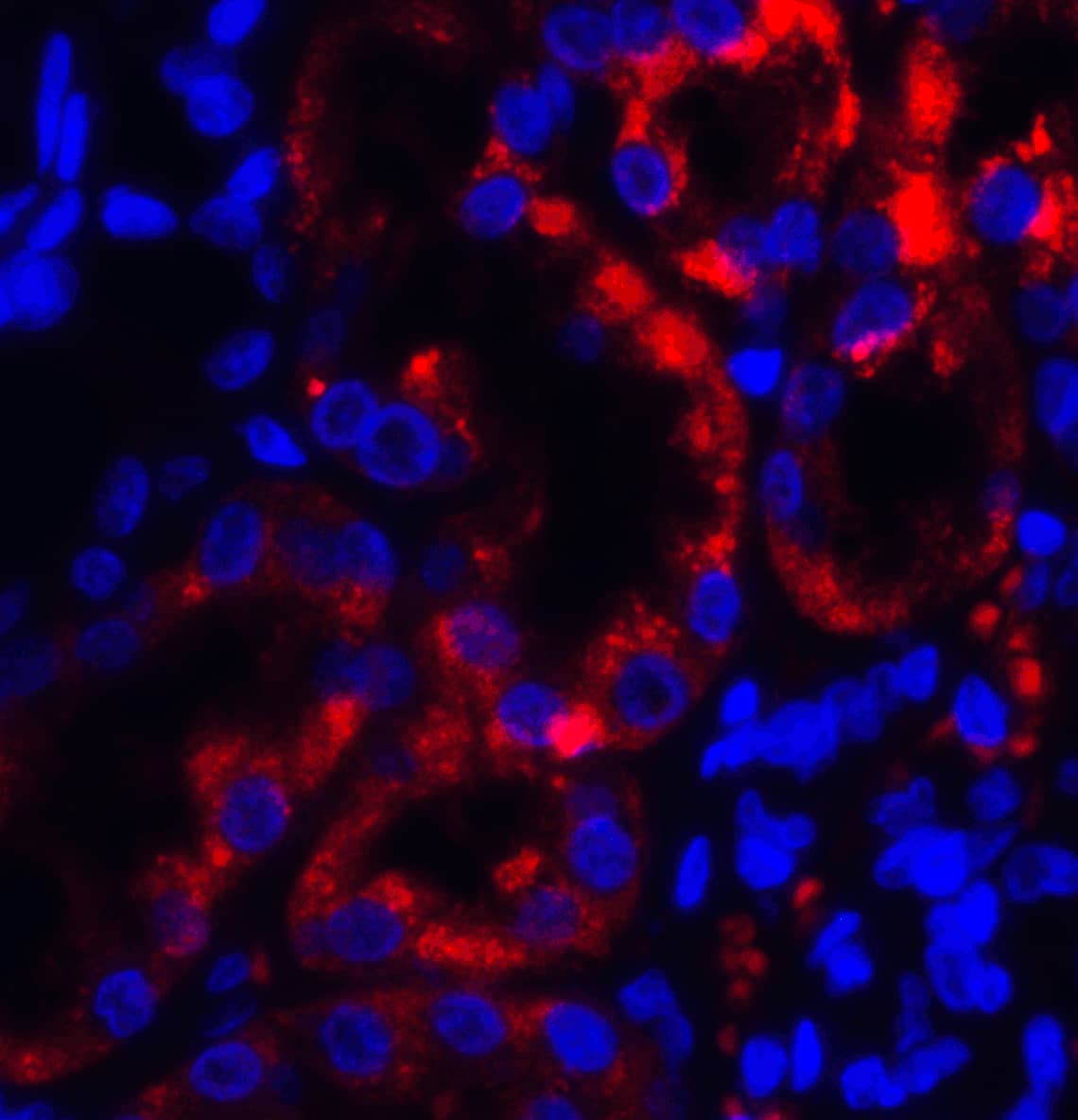 Immunocytochemistry/ Immunofluorescence TRPV4 Antibody - BSA Free