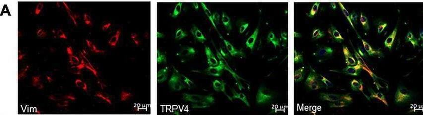 Immunofluorescence for Vim (red) and TRP or Piezo channels (green) in cultured LP-ICs. Double staining reveals the protein expression of TRPV4 (A), piezo1 (B), TRPA1 (C), TRPV2 (D), TRPV1 (E), TRPM8 (F) and Piezo2 (G) in most of the Vim+ LP-ICs. The nucleus marker (DAPI) is stained in blue. Image collected and cropped by CiteAb from the following open publication (//pubmed.ncbi.nlm.nih.gov/35069237), licensed under a CC-BY license. Not internally tested by Novus Biologicals.