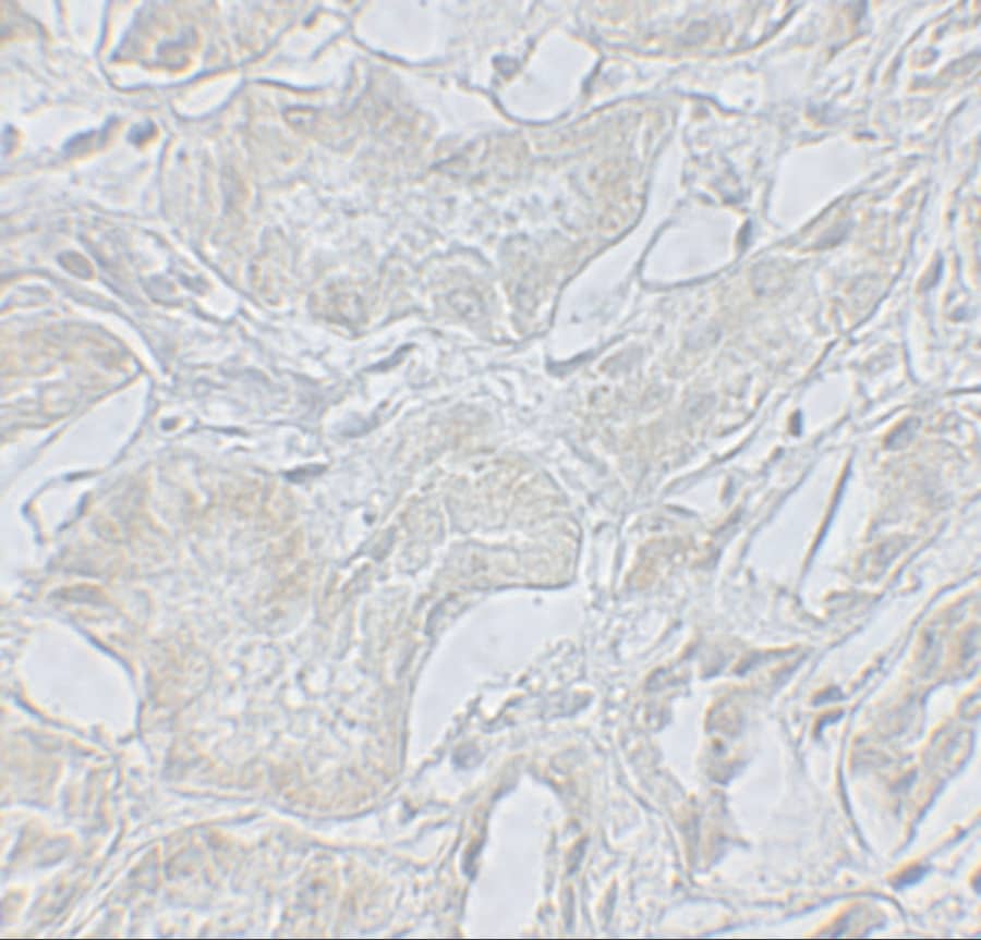 Immunohistochemistry ARF6 Antibody - BSA Free