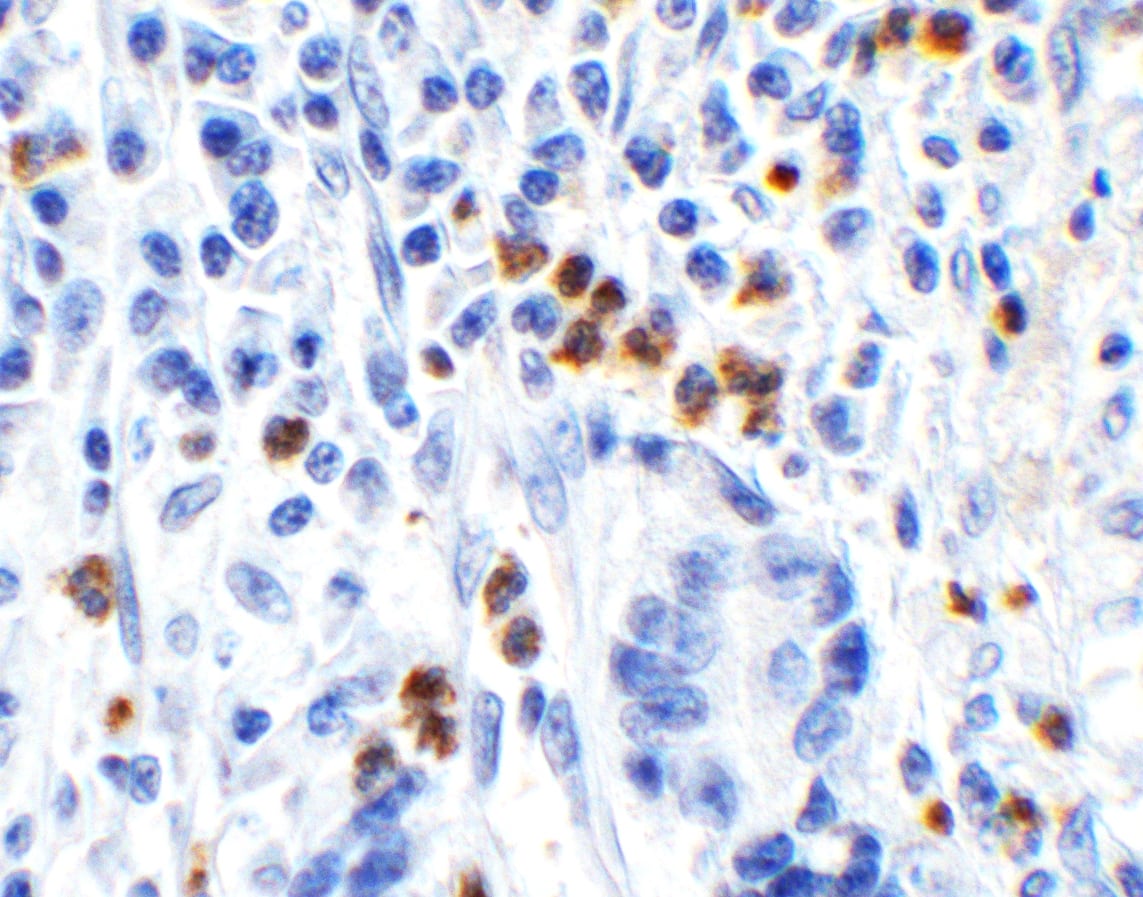 Immunohistochemistry: HMGB1/HMG-1 Antibody - BSA Free [NBP2-41264] - Validation of HMGB1/HMG-1 in Human Stomach Tissue.Immunohistochemical analysis of paraffin-embedded human stomach tissue using anti-HMGB1/HMG-1 antibody  at 1 ug/ml. Tissue was fixed with formaldehyde and blocked with 10% serum for 1 h at RT; antigen retrieval was by heat mediation with a citrate buffer (pH6). Samples were incubated with primary antibody overnight at 4C. A goat anti-rabbit IgG H&L (HRP) at 1/250 was used as secondary. Counter stained with Hematoxylin.