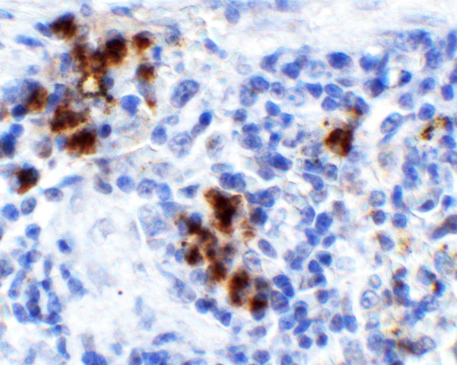 Immunohistochemistry: HMGB1/HMG-1 Antibody - BSA Free [NBP2-41264] - Validation of HMGB1/HMG-1 in Rat Spleen Tissue.  Immunohistochemical analysis of paraffin-embedded rat spleen tissue using anti-HMGB1/HMG-1 antibody  at 1 ul/ml. Tissue was fixed with formaldehyde and blocked with 10% serum for 1 h at RT; antigen retrieval was by heat mediation with a citrate buffer (pH6). Samples were incubated with primary antibody overnight at 4C. A goat anti-rabbit IgG H&L (HRP) at 1/250 was used as secondary. Counter stained with Hematoxylin.