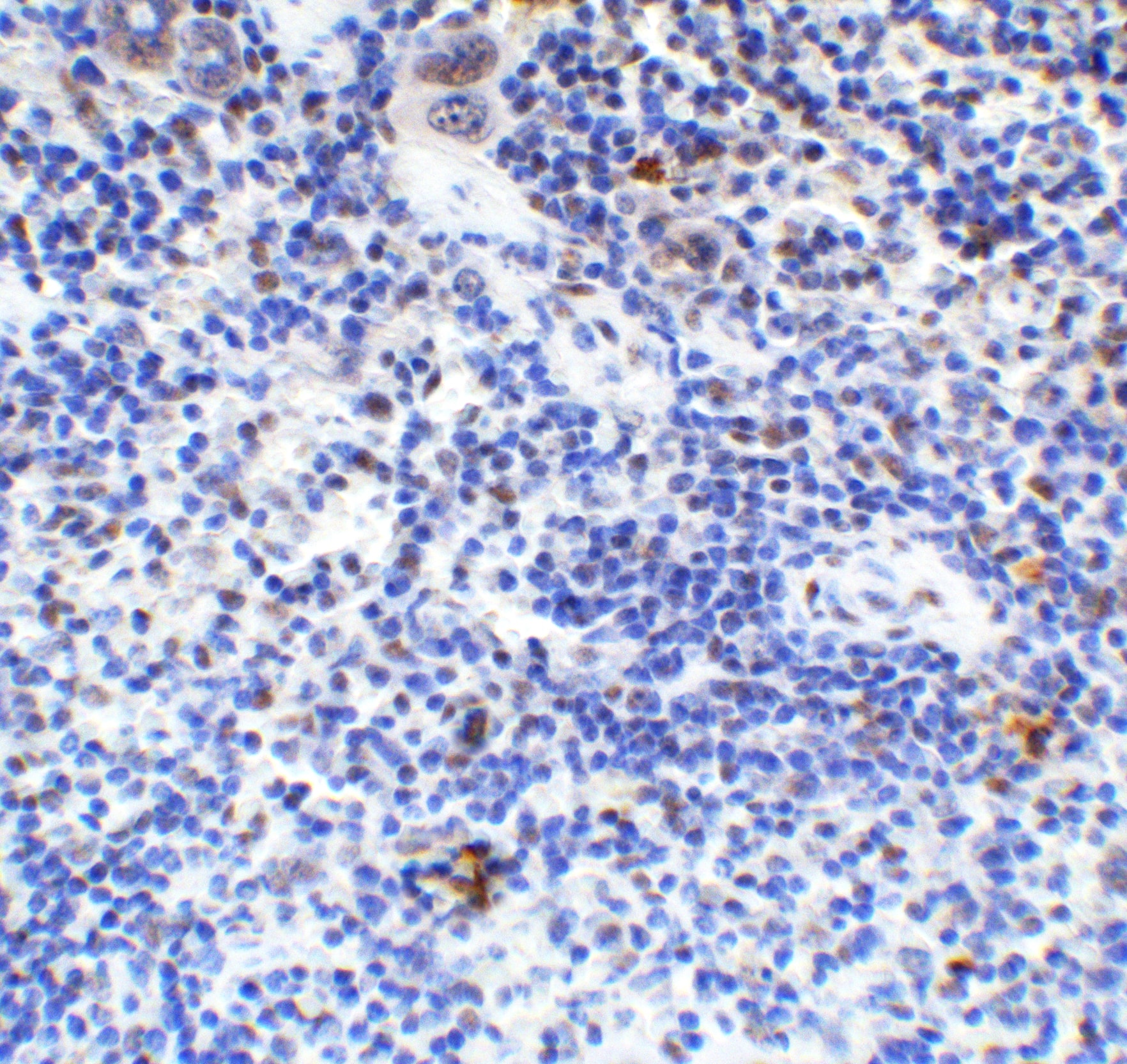 Immunohistochemistry: HMGB1/HMG-1 Antibody - BSA Free [NBP2-41264] - Validation of HMGB1/HMG-1 in Mouse Spleen Tissue.Immunohistochemical analysis of paraffin-embedded mouse spleen tissue using anti-HMGB1/HMG-1 antibody  at 2 ug/ml. Tissue was fixed with formaldehyde and blocked with 10% serum for 1 h at RT; antigen retrieval was by heat mediation with a citrate buffer (pH6). Samples were incubated with primary antibody overnight at 4C. A goat anti-rabbit IgG H&L (HRP) at 1/250 was used as secondary. Counter stained with Hematoxylin.