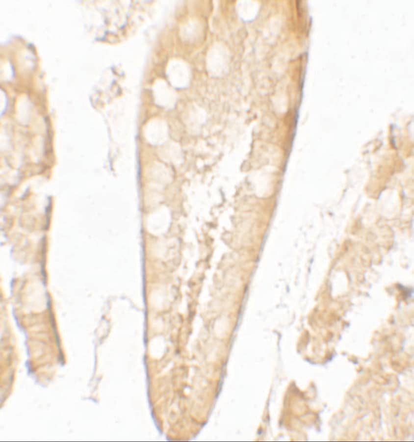 Immunohistochemistry: CFTR Antibody - BSA Free [NBP2-41265] - Immunohistochemistry of CFTR in human small intestine tissue with CFTR antibody at 5 ug/mL.