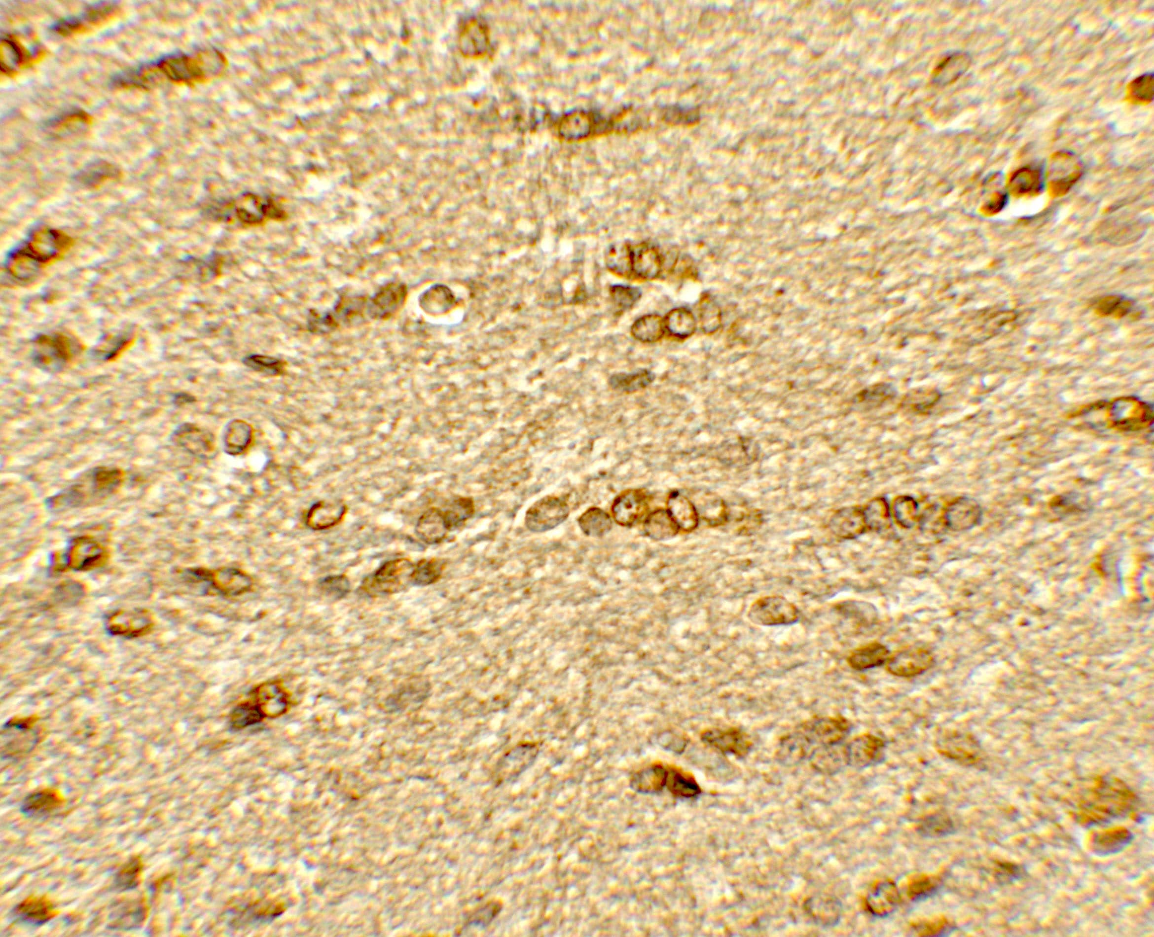 Immunohistochemistry: Olig2 Antibody - BSA Free [NBP2-41269] - Immunohistochemistry of Olig2 in rat brain tissue with Olig2 antibody at 5 ug/mL.