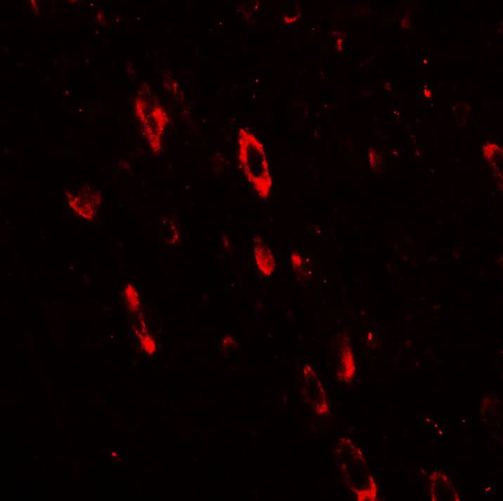 Immunocytochemistry/ Immunofluorescence: Olig2 Antibody - BSA Free [NBP2-41269] - Immunofluorescence of Olig2 in rat brain tissue with Olig2 antibody at 20 ug/mL.