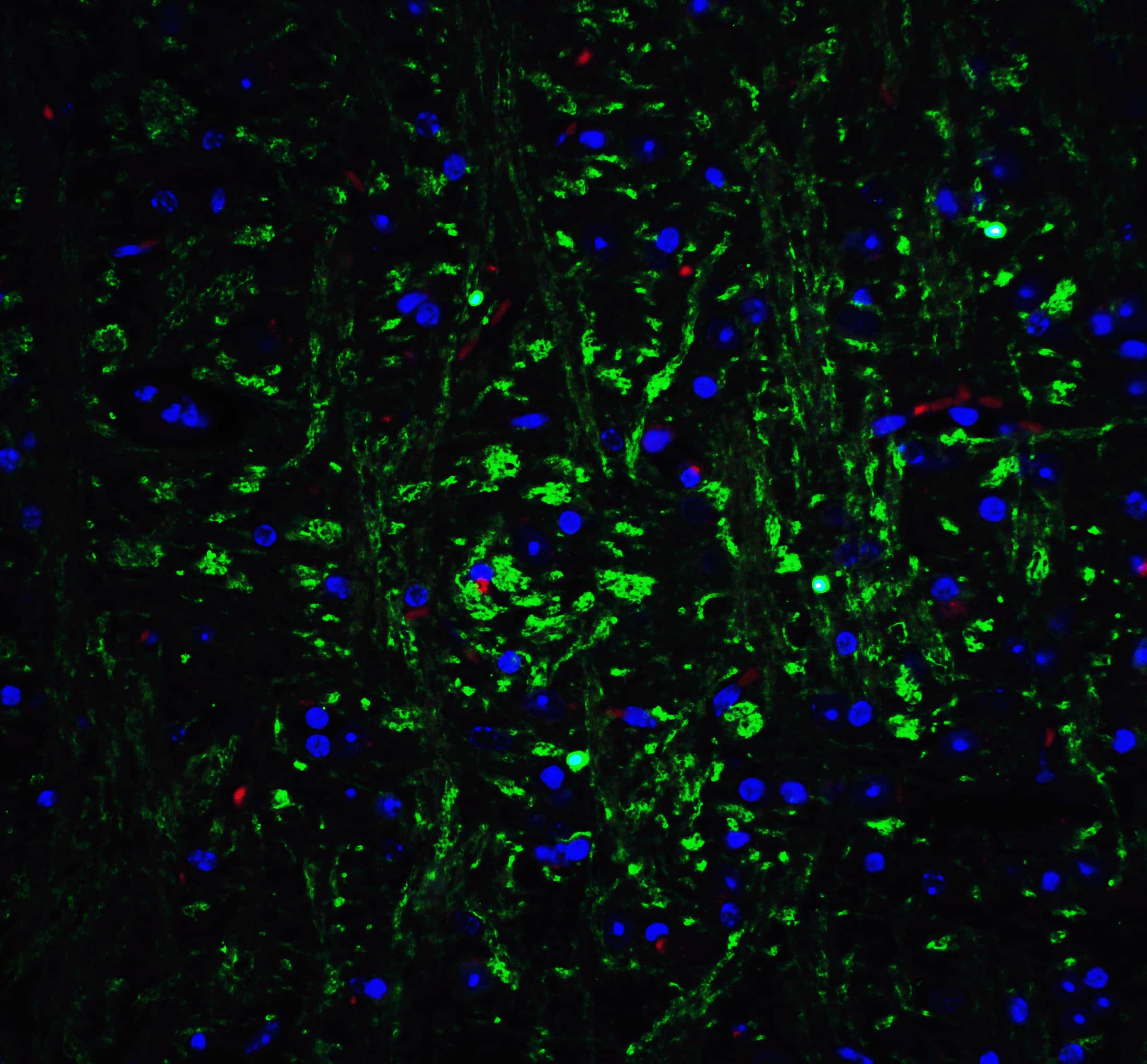 Immunocytochemistry/ Immunofluorescence: Olig2 Antibody - BSA Free [NBP2-41269] - Immunofluorescence of Olig2 in mouse brain tissue with Olig2 Antibody at 20 ug/mL.Green: Olig2 antibody   Red: Phylloidin staining Blue: DAPI staining