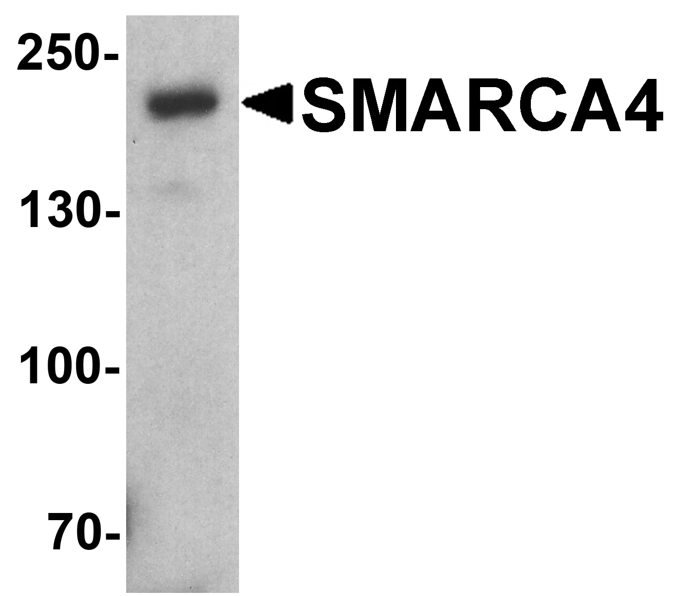 Western Blot: Brg1 Antibody - BSA Free [NBP2-41270] - Western blot analysis of Brg1 in SK-N-SH cell lysate with Brg1 antibody at 1 u/ml.