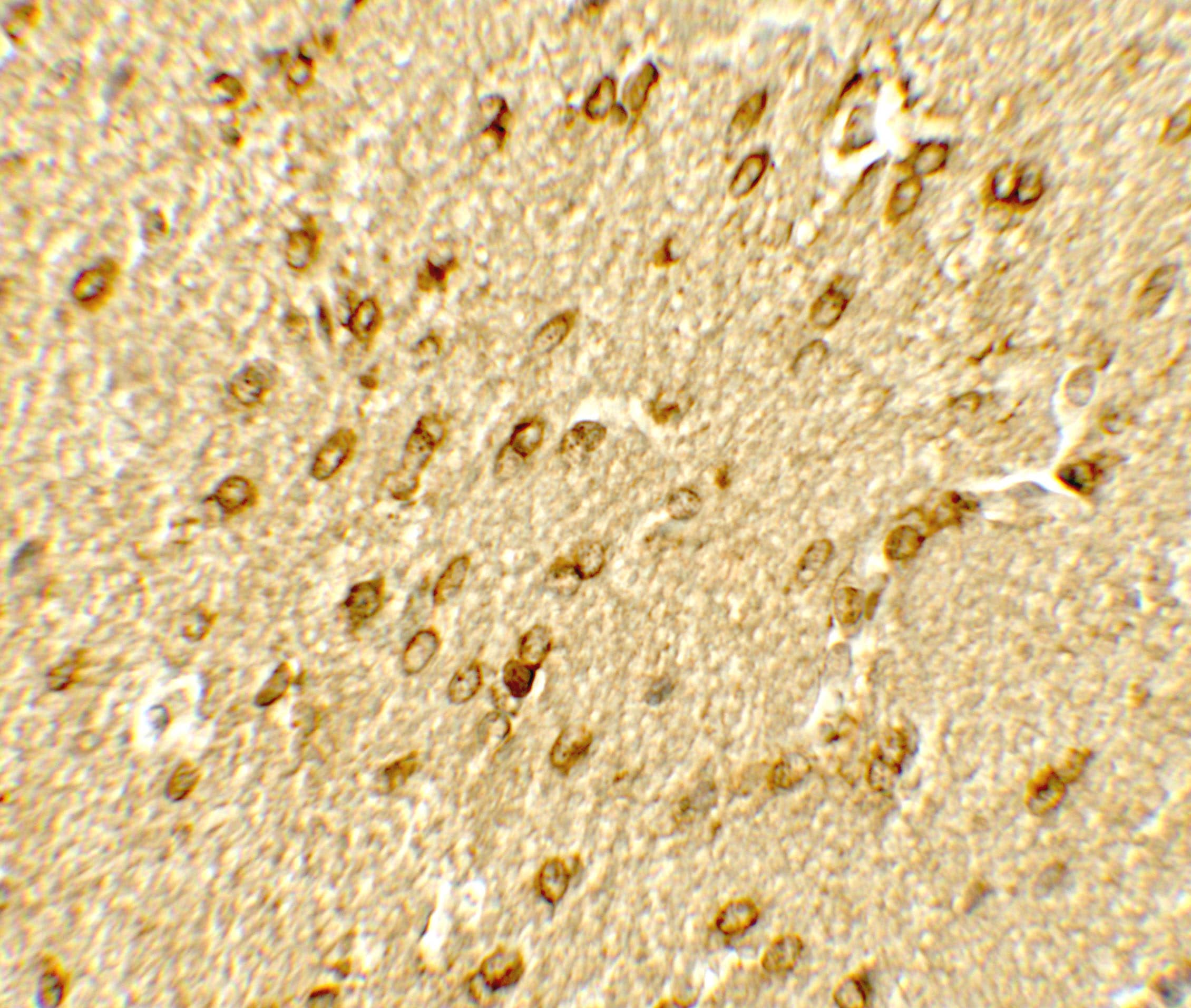 Immunohistochemistry: Brg1 Antibody - BSA Free [NBP2-41270] - Immunohistochemistry of Brg1 in rat brain tissue with Brg1 antibody at 5 u/mL.