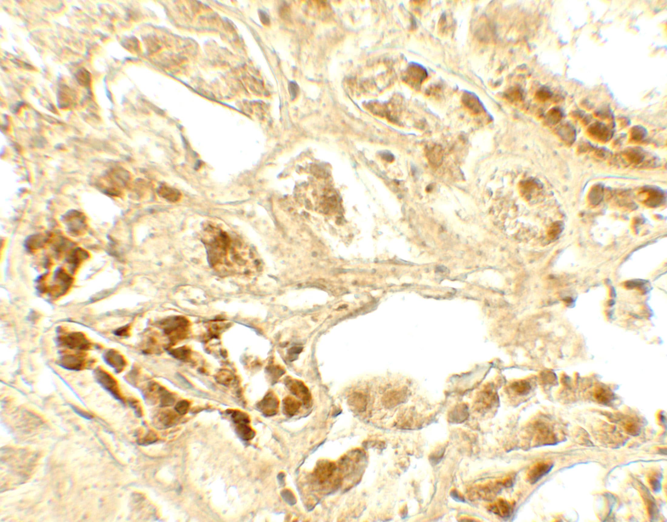 Immunohistochemistry: Calcium-sensing R/CaSR Antibody - BSA Free [NBP2-41271] - Immunohistochemistry of Calcium-sensing R/CaSR in human kidney tissue with Calcium-sensing R/CaSR antibody at 5 ug/mL.