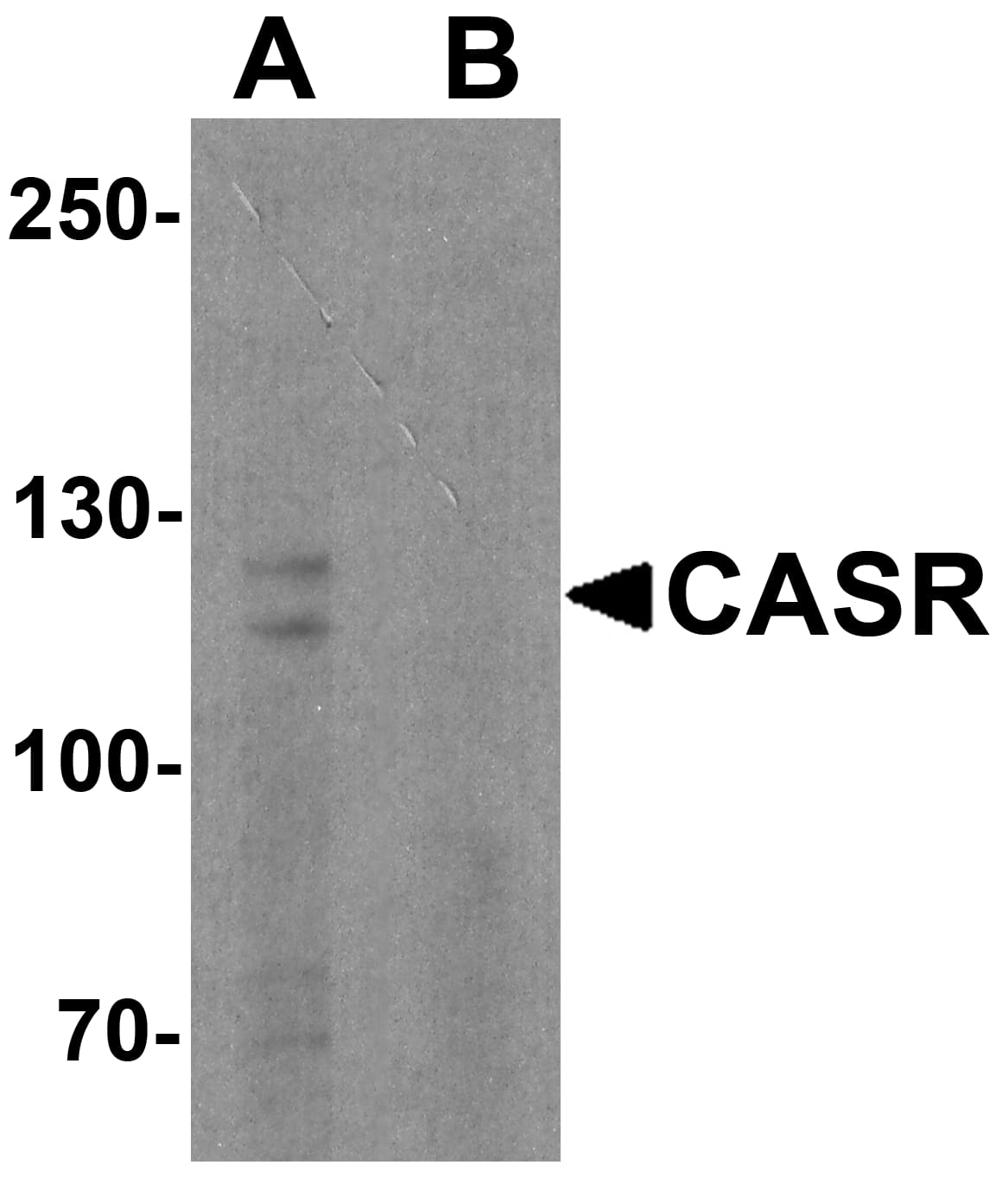 Western Blot: Calcium-sensing R/CaSR Antibody - BSA Free [NBP2-41271] - Western blot analysis of Calcium-sensing R/CaSR in EL4 cell lysate with Calcium-sensing R/CaSR antibody at 1 ug/ml in (A) the absence and (B) the presence of blocking peptide.