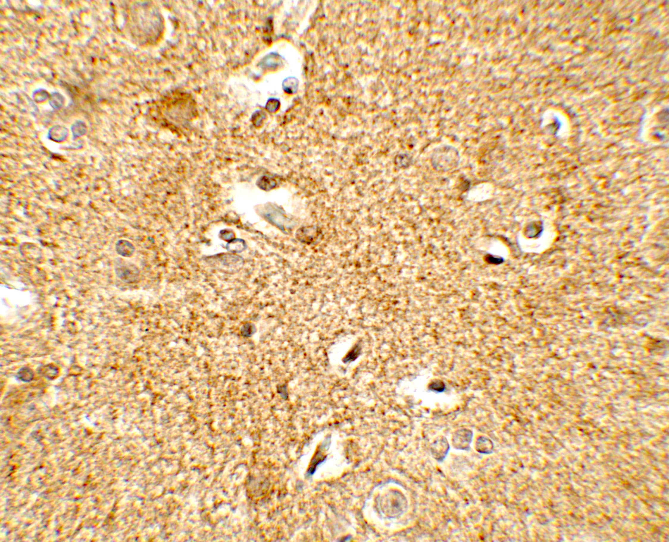 Immunohistochemistry Corticotropin Releasing Factor Antibody - BSA Free