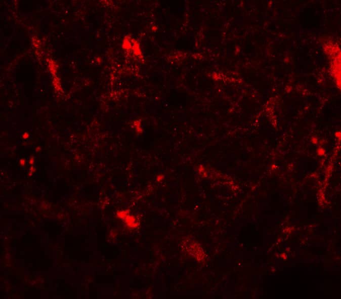 Immunocytochemistry/ Immunofluorescence: Corticotropin Releasing Factor Antibody - BSA Free [NBP2-41273] - Immunofluorescence of Corticotropin Releasing Factor in human brain tissue with Corticotropin Releasing Factor antibody at 20 ug/mL.