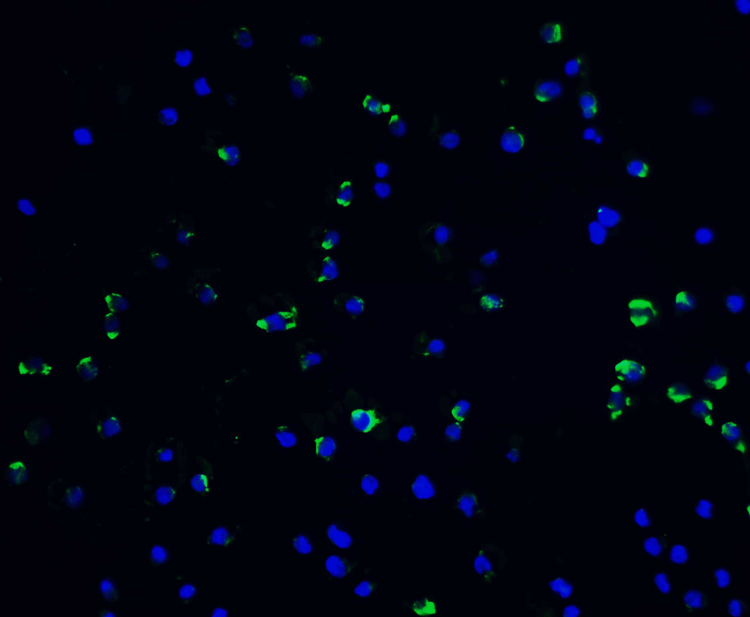 Immunocytochemistry/ Immunofluorescence: Vinculin Antibody - BSA Free [NBP2-41274] - Validation of Vinculin in Jurkat Cells. Immunofluorescent analysis of 4% paraformaldehyde-fixed Jurkat cells labeling Vinculin with  at 20 ug/mL, followed by goat anti-rabbit IgG secondary antibody at 1/500 dilution (green) and DAPI staining (blue). 