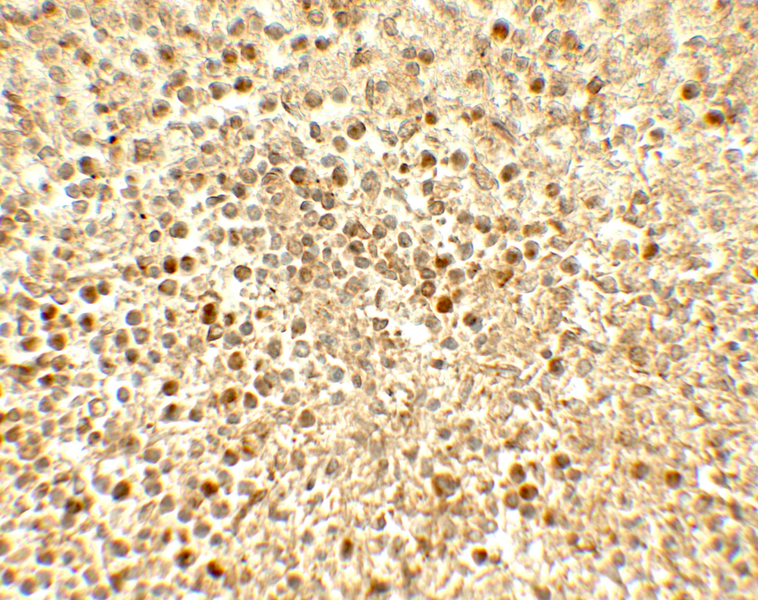 Immunohistochemistry: SREBP2 Antibody - BSA Free [NBP2-41282] - Immunohistochemistry of SREBP2 in human spleen tissue with SREBP2 antibody at 5 u/mL.