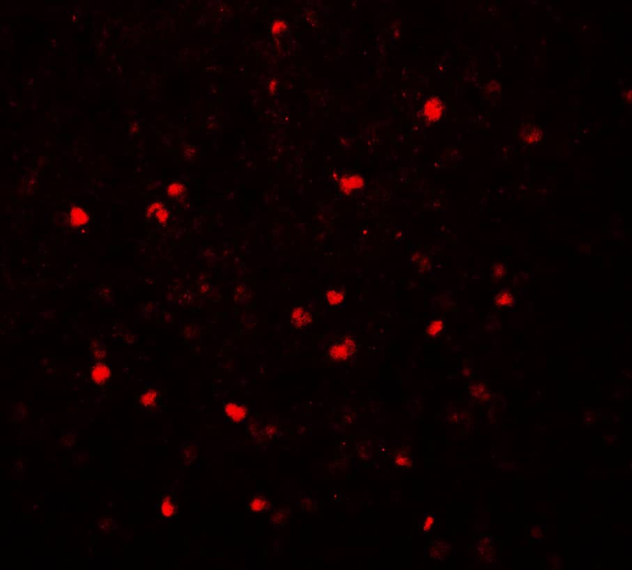 Immunocytochemistry/ Immunofluorescence: SREBP2 Antibody - BSA Free [NBP2-41282] - Immunofluorescence of SREBP2 in human spleen tissue with SREBP2 antibody at 20 u/mL.