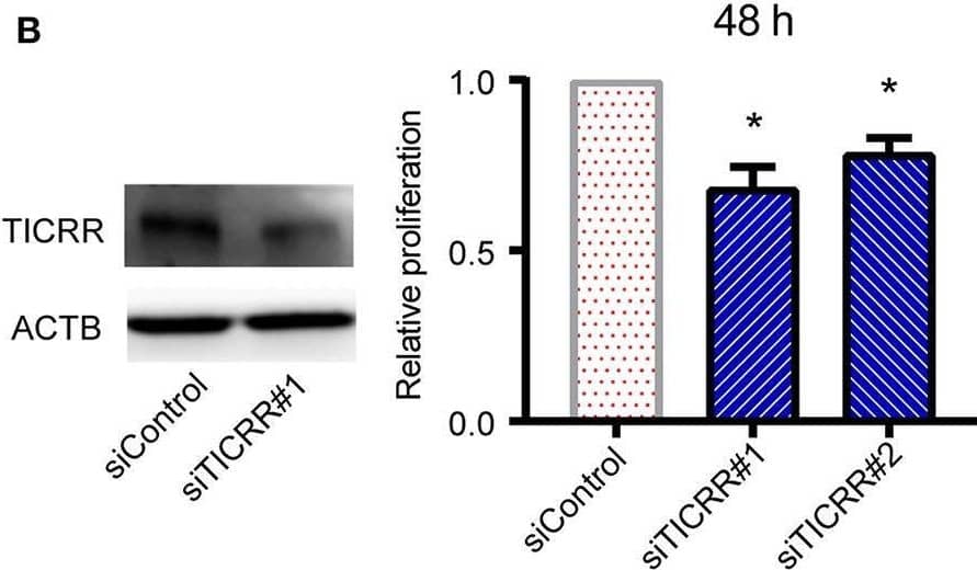 Western Blot TICRR Antibody - BSA Free