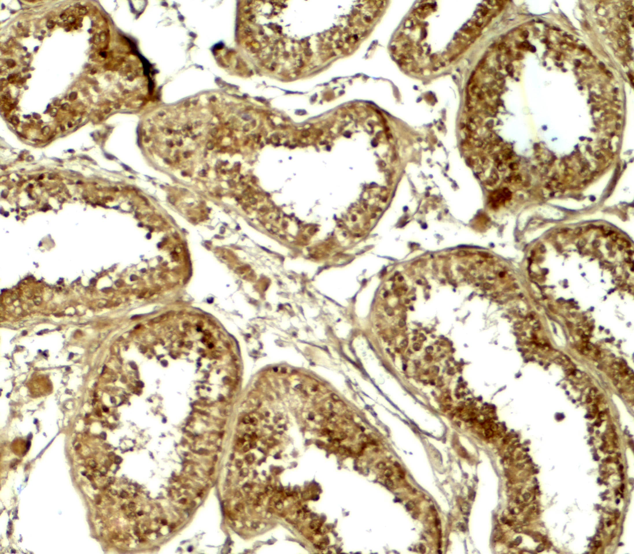 Immunohistochemistry: HDAC6 Antibody - BSA Free [NBP2-41286] - Immunohistochemistry of HDAC6 in human testis tissue with HDAC6 antibody at 5 ug/ml.