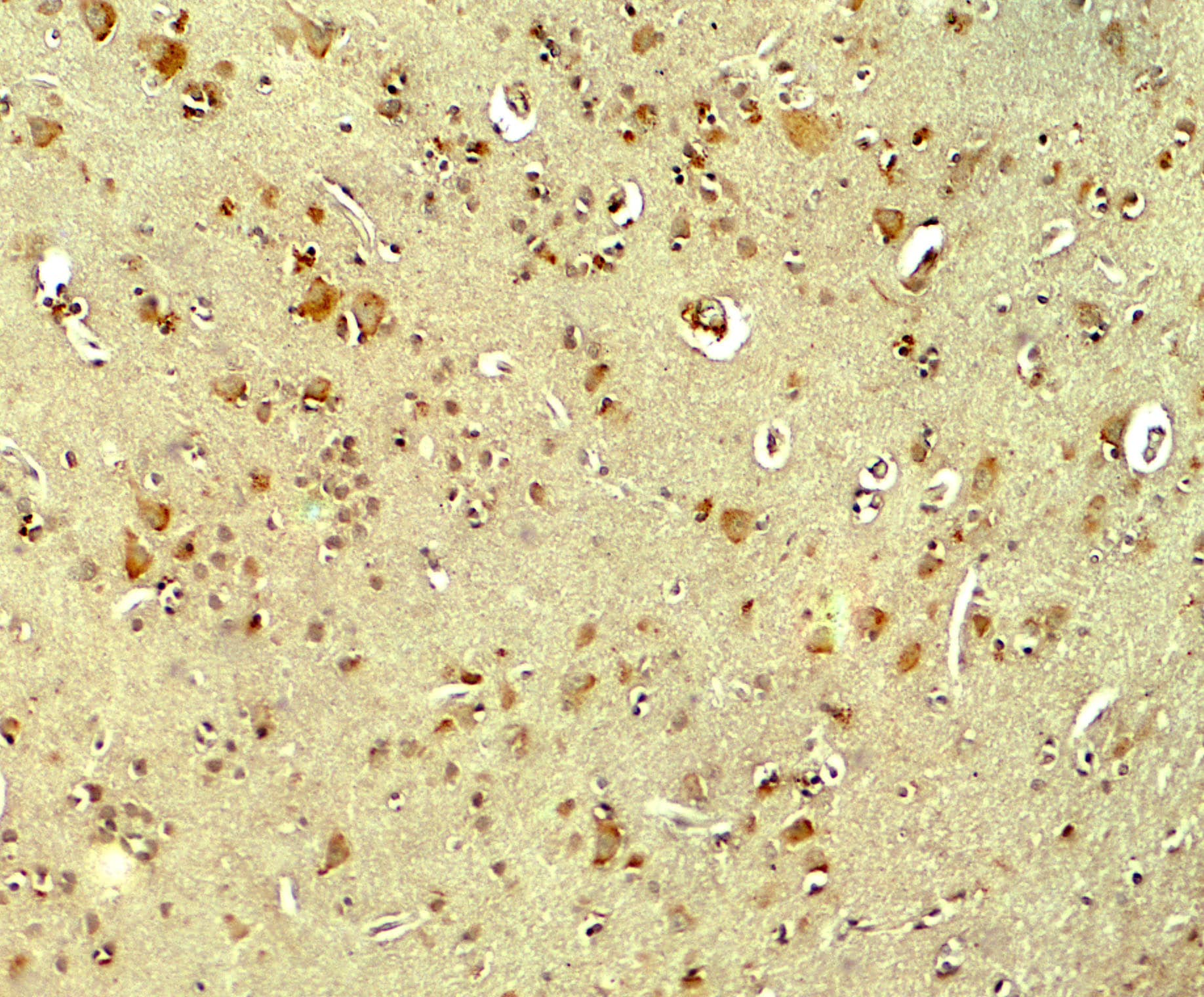 Immunohistochemistry: Parkin Antibody - BSA Free [NBP2-41287] - Immunohistochemistry of Parkin in human brain tissue with Parkin antibody at 5 ug/ml.