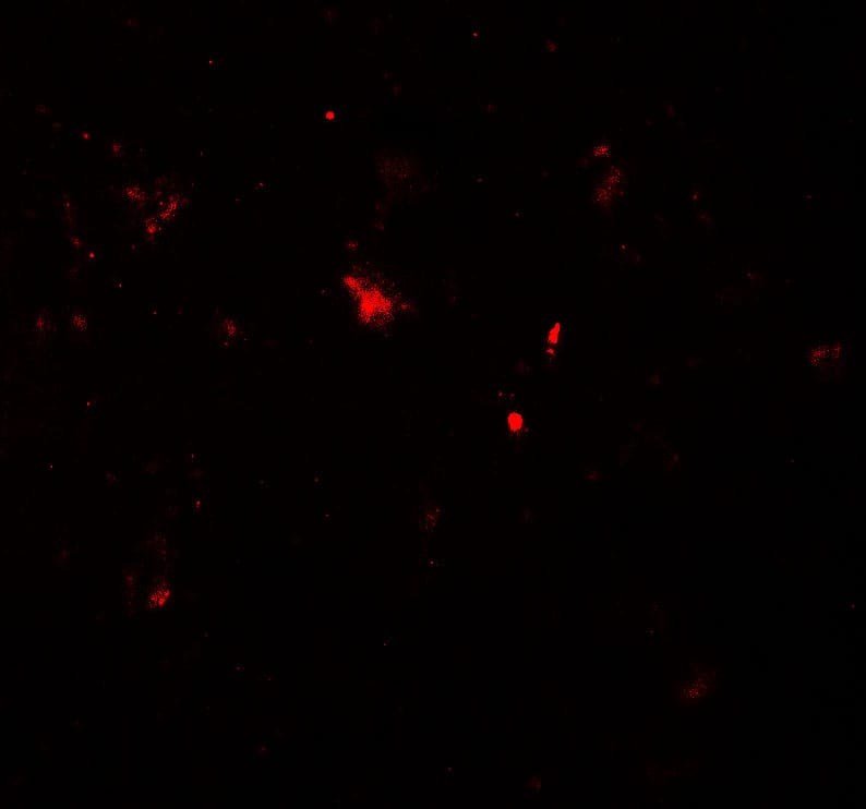 Immunocytochemistry/ Immunofluorescence: Parkin Antibody - BSA Free [NBP2-41287] - Immunofluorescence of Parkin in human brain tissue with Parkin antibody at 20 u/ml.