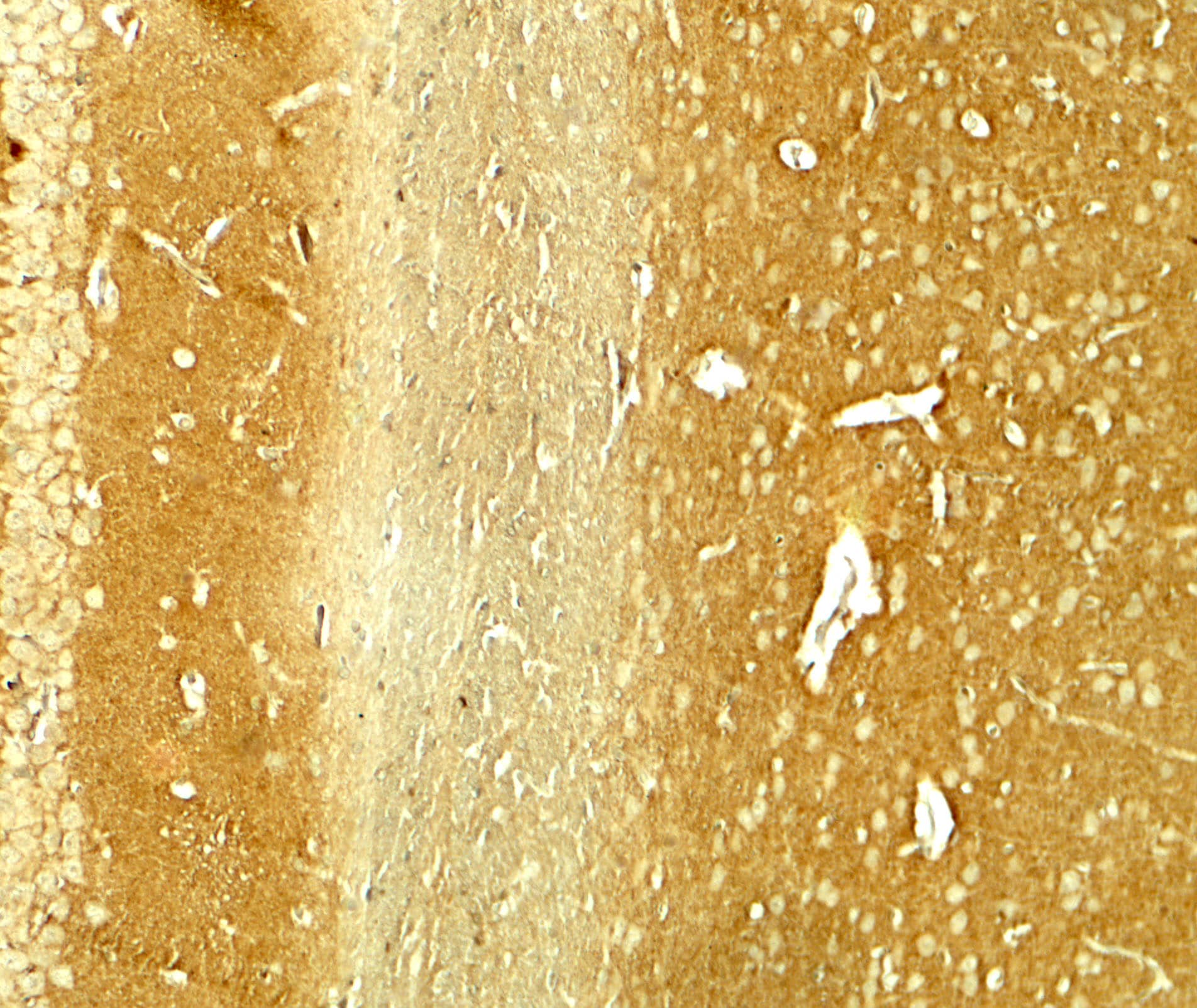 Immunohistochemistry: alpha-Synuclein Antibody - BSA Free [NBP2-41288] - Immunohistochemistry of alpha-Synuclein in rat brain tissue with alpha-Synuclein antibody at 5 ug/ml.