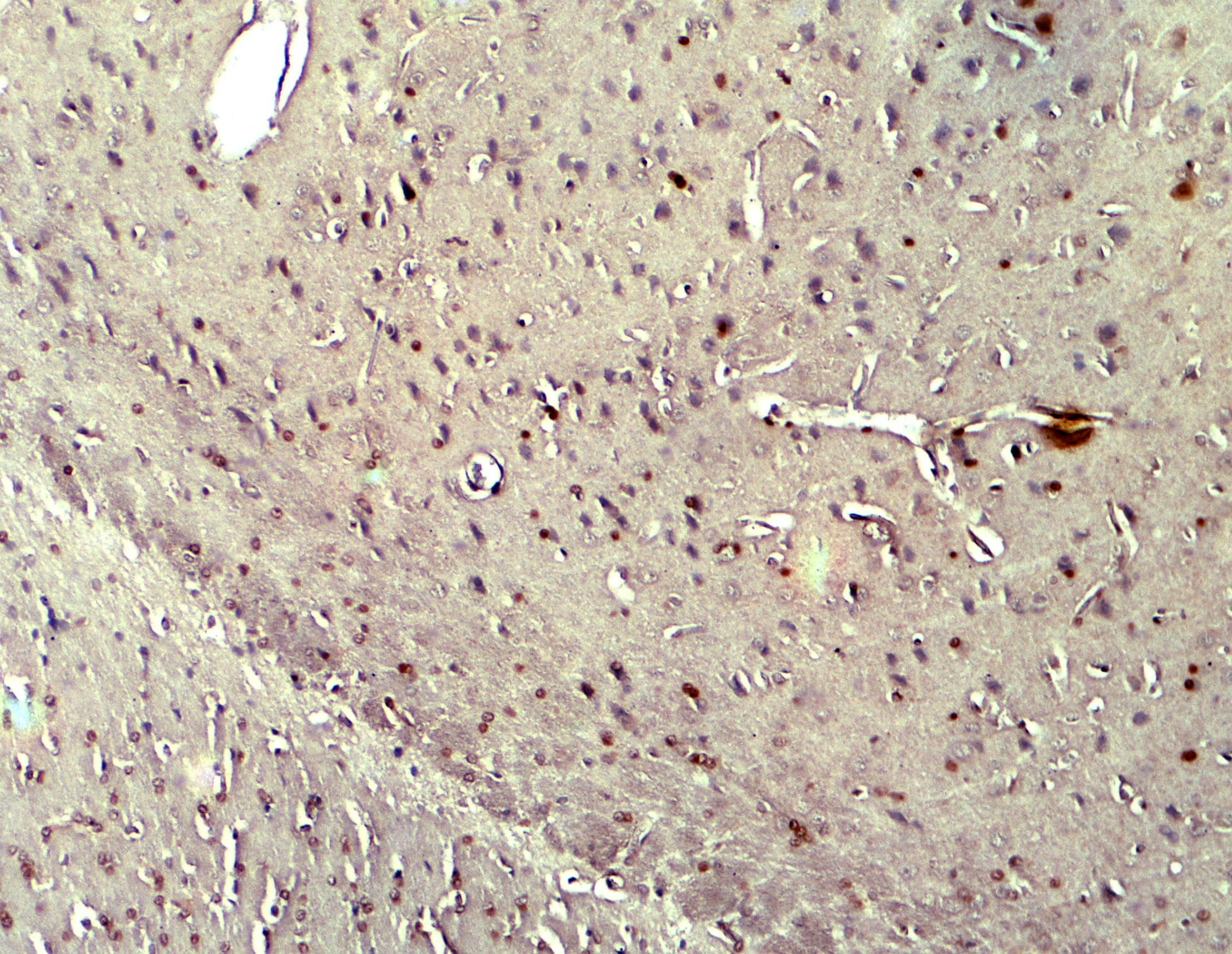 Immunohistochemistry: CYBB/NOX2 Antibody - BSA Free [NBP2-41291] - Immunohistochemistry of CYBB/NOX2 in rat brain tissue with CYBB/NOX2 antibody at 5 u/ml.