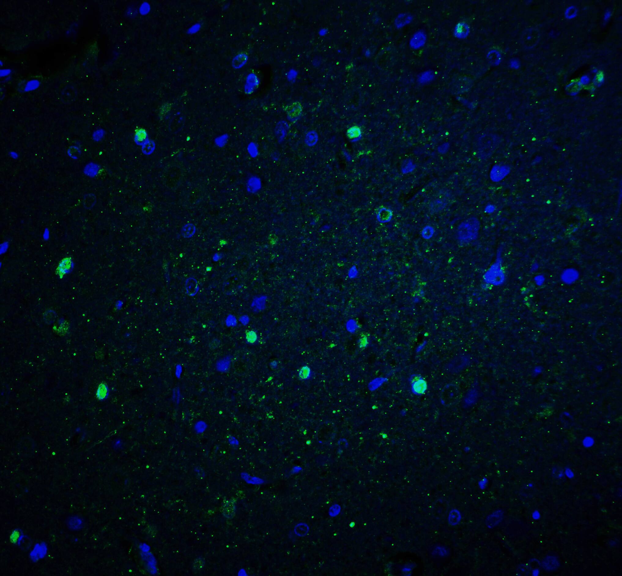 Immunocytochemistry/ Immunofluorescence: CYBB/NOX2 Antibody - BSA Free [NBP2-41291] - Immunofluorescence of CYBB/NOX2 in rat brain tissue with CYBB/NOX2 antibody at 20 u/ml.Green: CYBB/NOX2 Antibody   Blue: DAPI staining