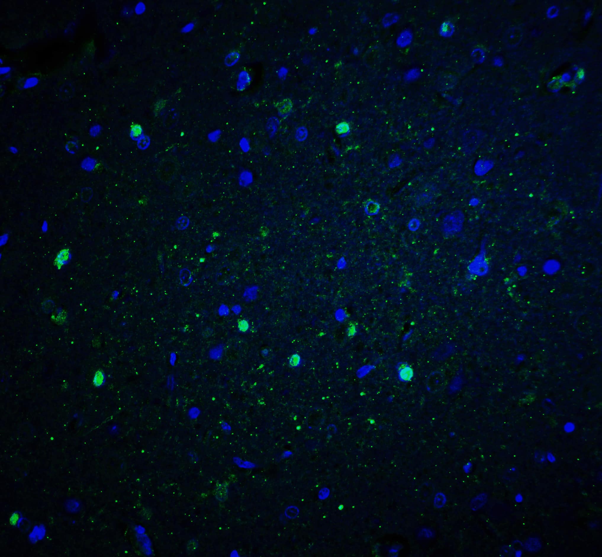 Immunocytochemistry/ Immunofluorescence: CYBB/NOX2 Antibody - BSA Free [NBP2-41291] - Immunofluorescence of CYBB/NOX2 in rat brain tissue with CYBB/NOX2 antibody at 20 u/ml.Green: CYBB/NOX2 Antibody   Blue: DAPI staining