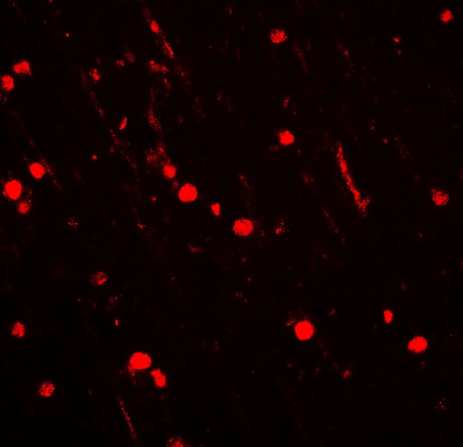 Immunocytochemistry/ Immunofluorescence: CYBB/NOX2 Antibody - BSA Free [NBP2-41291] - Immunofluorescence of CYBB/NOX2 in rat brain tissue with CYBB/NOX2 antibody at 20 u/ml.