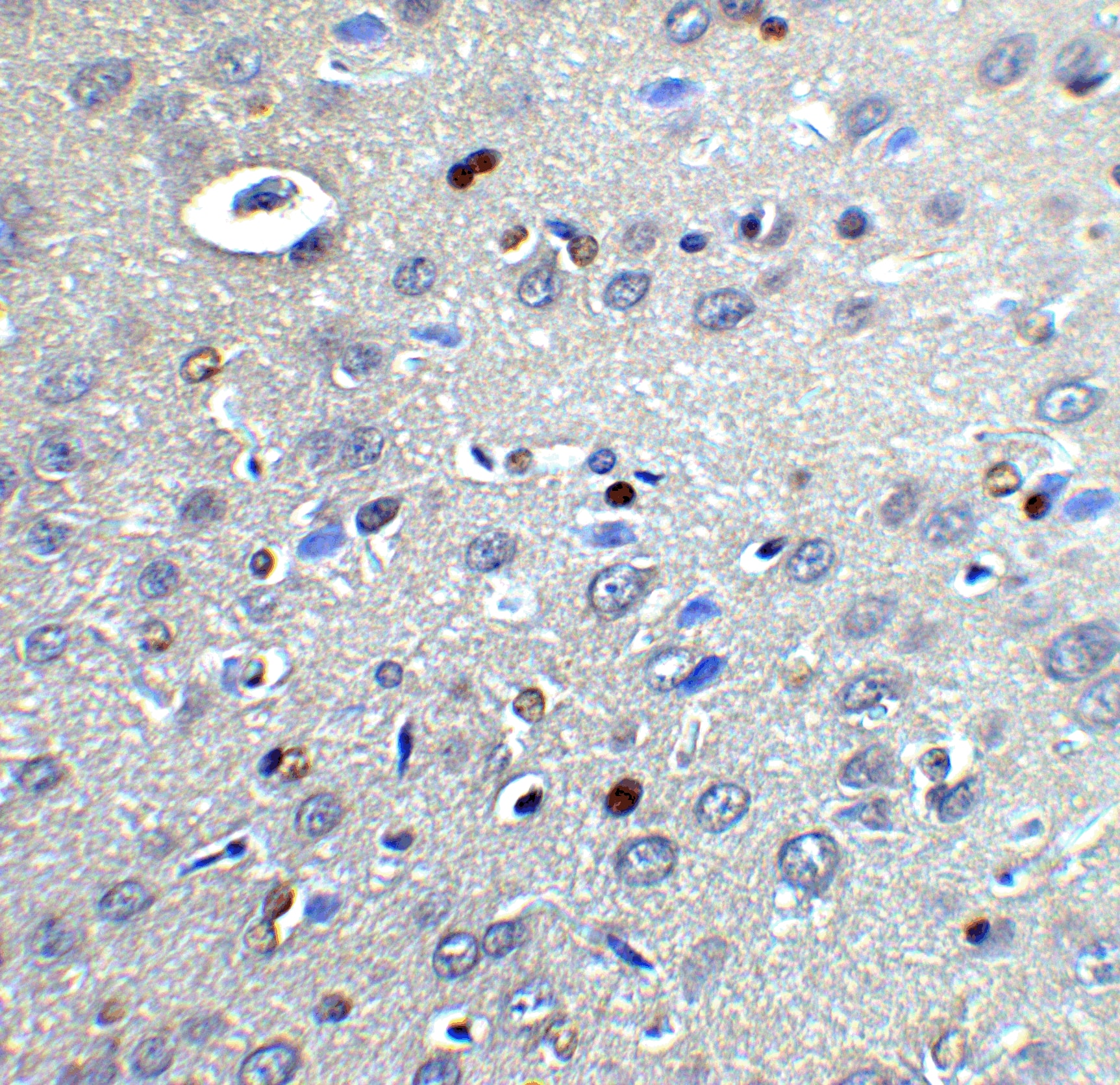 Immunohistochemistry: CYBB/NOX2 Antibody - BSA Free [NBP2-41291] - Immunohistochemistry of CYBB/NOX2 in rat brain tissue cells with CYBB/NOX2 antibody at 2 u/ml.