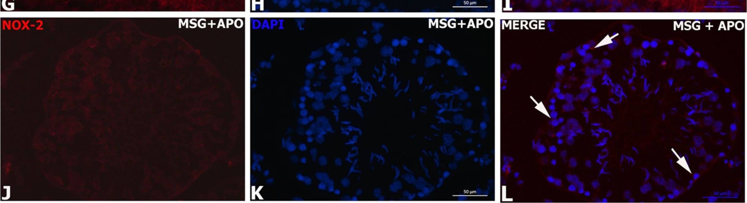 Immunofluorescence analysis of NOX-2 in experimental groups (A–L). The nuclei were labeled with DAPI (blue). NOX-2 expression was similar in the control, APO, and MSG + APO groups. An increased number of NOX-2-positive cells (red) were observed in the MSG group. White arrows indicate NOX-2-positive cells. Scale bar: 50 μm. Image collected and cropped by CiteAb from the following open publication (//www.mdpi.com/2075-1729/13/3/822), licensed under a CC-BY license. Not internally tested by Novus Biologicals.