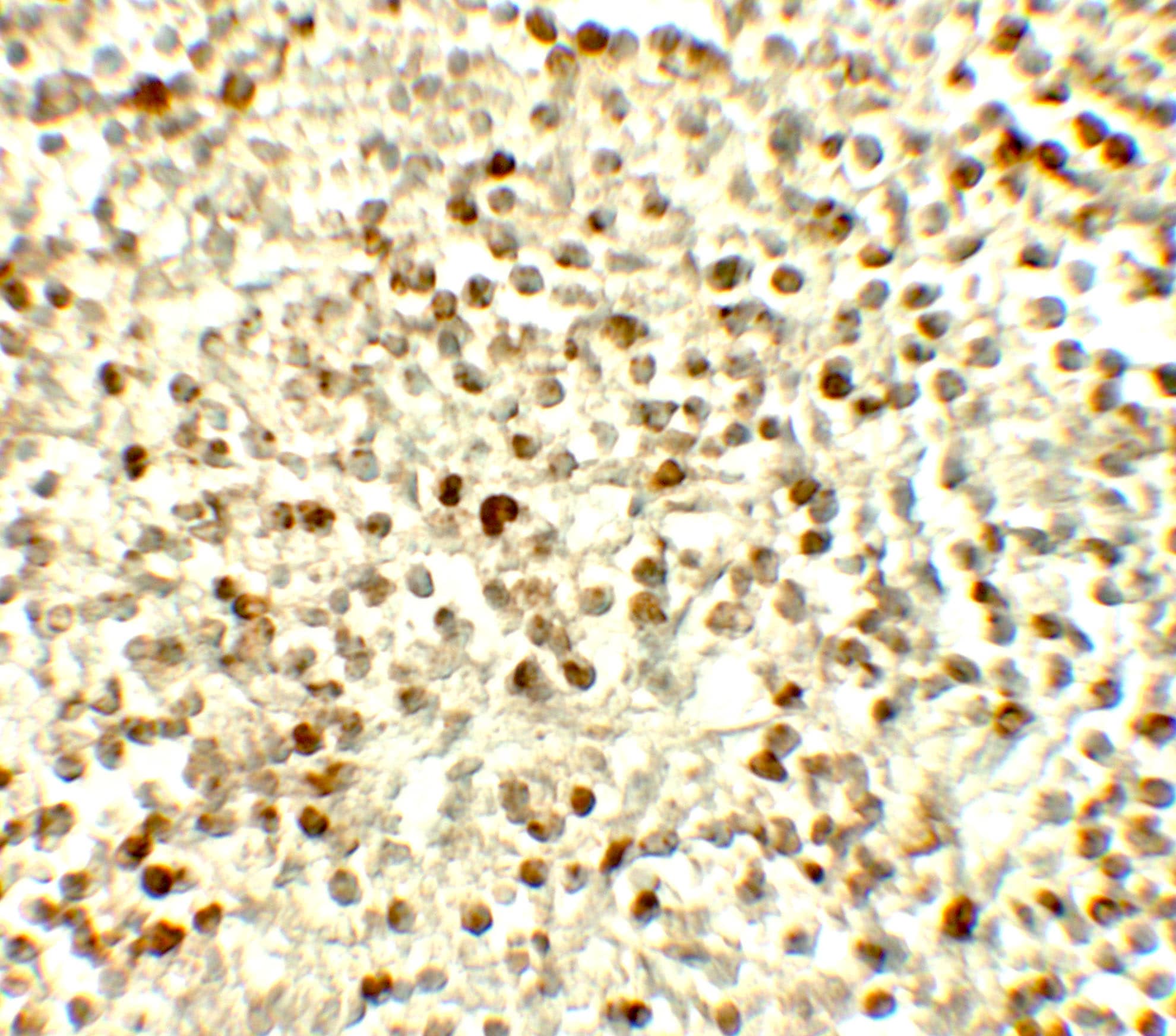 Immunohistochemistry: Nox4 Antibody - BSA Free [NBP2-41293] - Immunohistochemistry of Nox4 in human spleen tissue with Nox4 antibody at 5 u/ml.