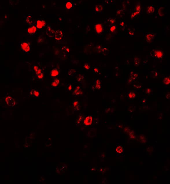 Immunocytochemistry/ Immunofluorescence: Nox4 Antibody - BSA Free [NBP2-41293] - Immunofluorescence of Nox4 in human spleen tissue with Nox4 antibody at 20 ug/ml.