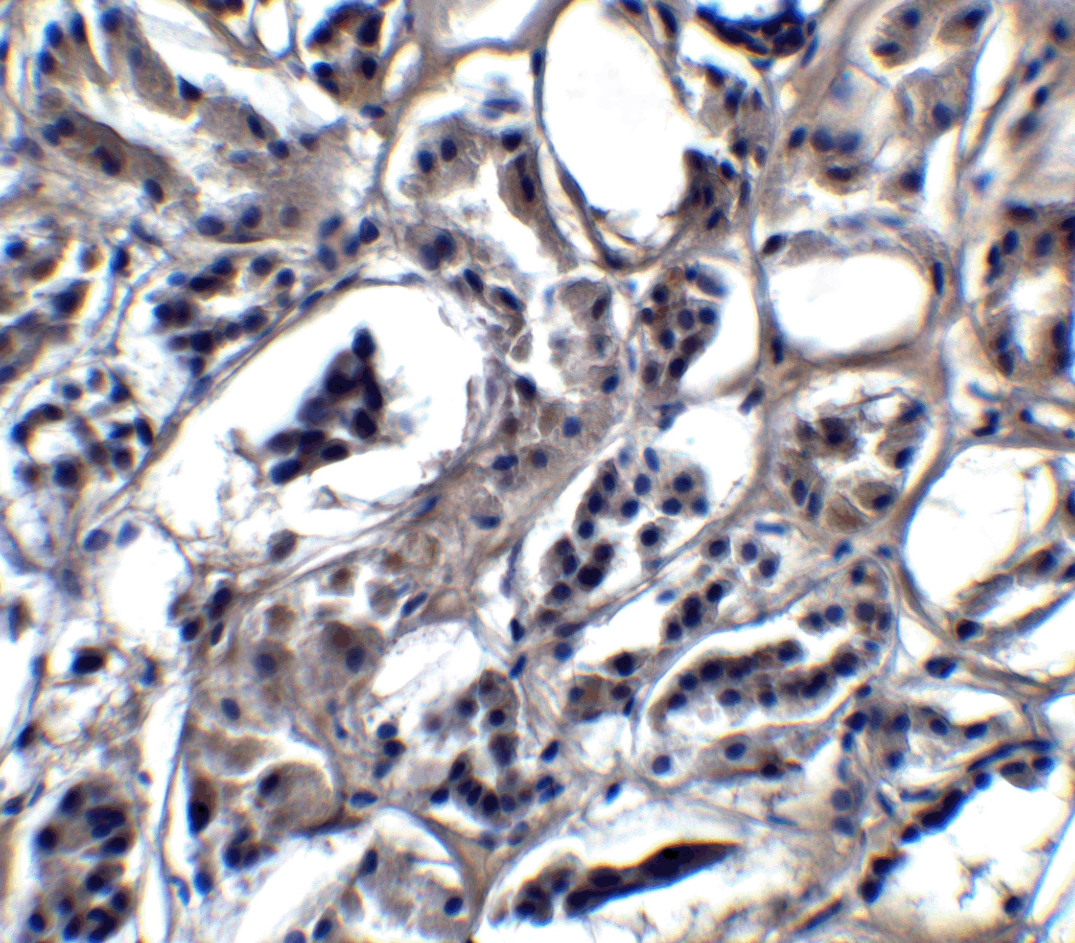 Immunohistochemistry: BATF3 Antibody - BSA Free [NBP2-41296] - Immunohistochemistry of BATF3 in human kidney tissue with BATF3 antibody at 5 u/mL.