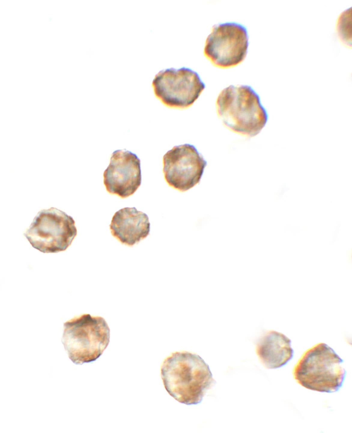 Immunocytochemistry/ Immunofluorescence: P2X7/P2RX7 Antibody - BSA Free [NBP2-41300] - Immunocytochemistry of P2X7/P2RX7 in 3T3 cells with P2X7/P2RX7 antibody at 5 u/mL.