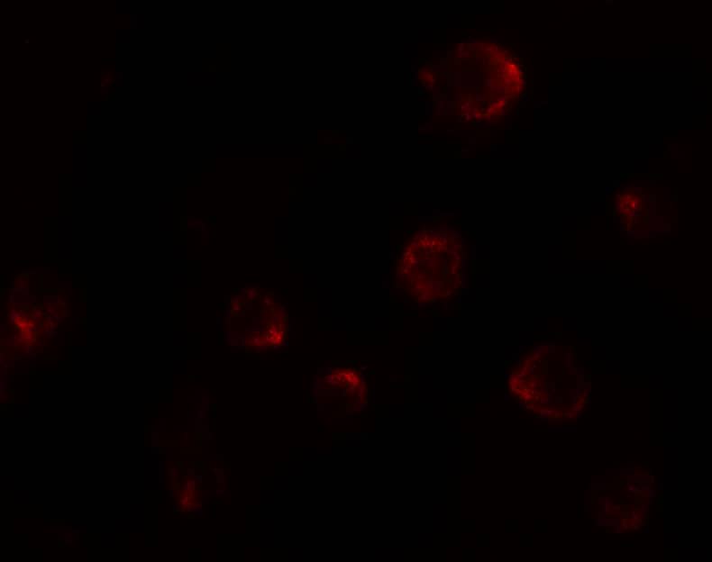 Immunocytochemistry/ Immunofluorescence: P2X7/P2RX7 Antibody - BSA Free [NBP2-41300] - Immunofluorescence of P2X7/P2RX7 in 3T3 cells with P2X7/P2RX7 antibody at 20 ug/mL.