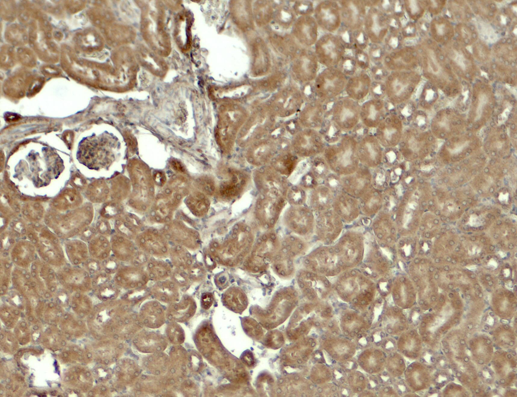 Immunohistochemistry: SESN2 Antibody - BSA Free [NBP2-41302] - Immunohistochemistry of SESN2 in mouse kidney tissue with SESN2 antibody at 5 ug/ml.