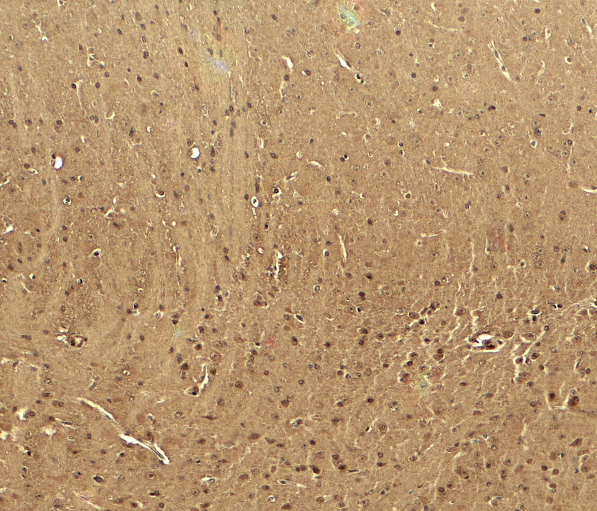 Immunohistochemistry: Cav3.2 Antibody - BSA Free [NBP2-41303] - Immunohistochemistry of Cav3.2 in mouse brain tissue with Cav3.2 antibody at 5 u/ml.