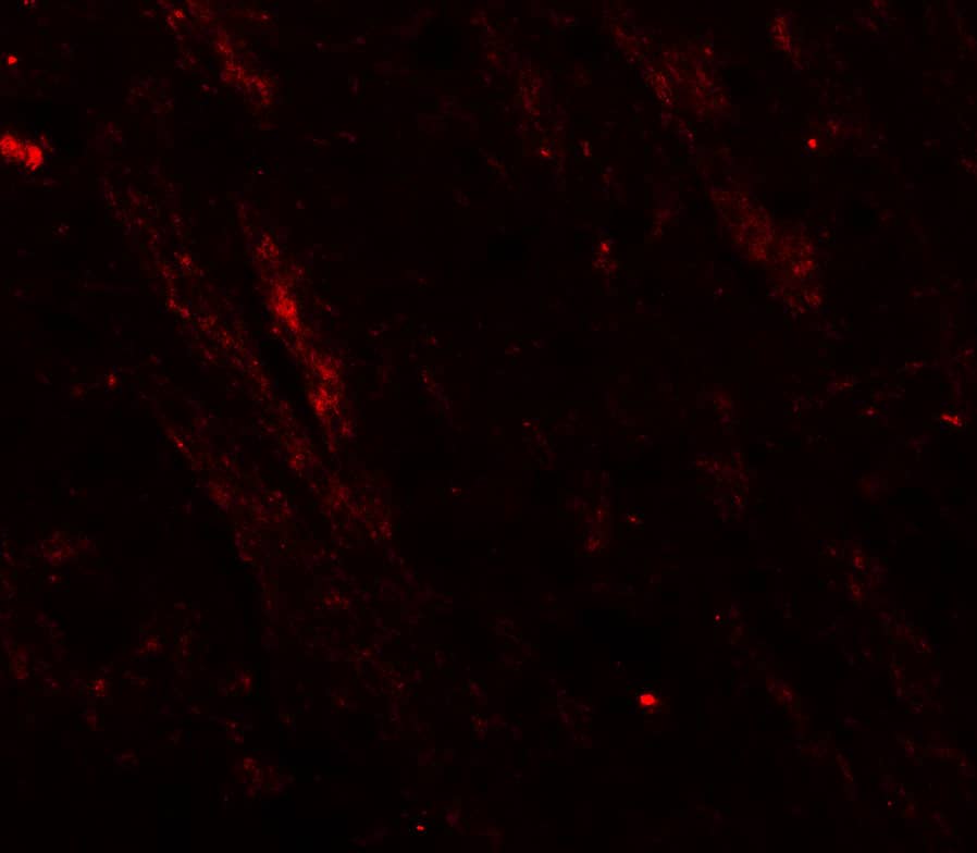 Immunocytochemistry/ Immunofluorescence: Cav3.2 Antibody - BSA Free [NBP2-41303] - Immunofluorescence of Cav3.2 in mouse brain tissue with Cav3.2 antibody at 20 u/ml.