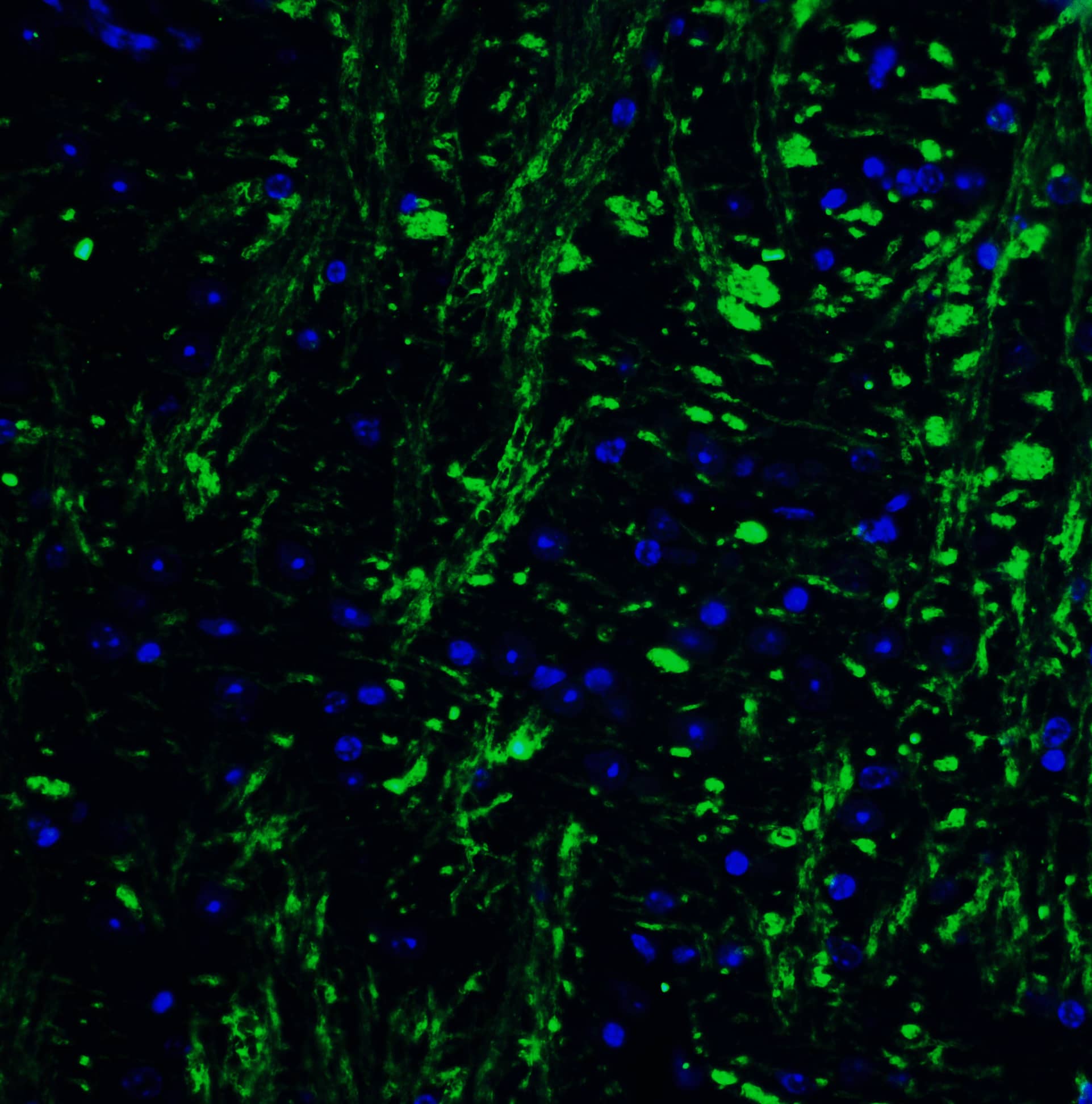 Immunocytochemistry/ Immunofluorescence: HES5 Antibody - BSA Free [NBP2-41305] - Immunofluorescence of HES5 in mouse brain tissue with HES5 Antibody at 20 u/mL.Green: HES5 Antibody   Blue: DAPI staining