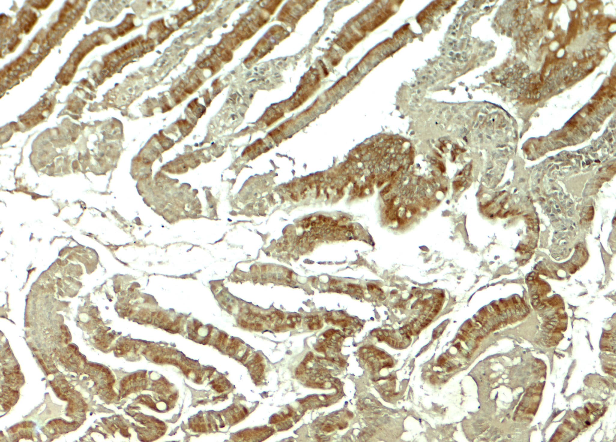 Immunohistochemistry: Wnt-5b Antibody - BSA Free [NBP2-41306] - Immunohistochemistry of Wnt-5b in rat colon tissue with Wnt-5b antibody at 5 ug/mL.