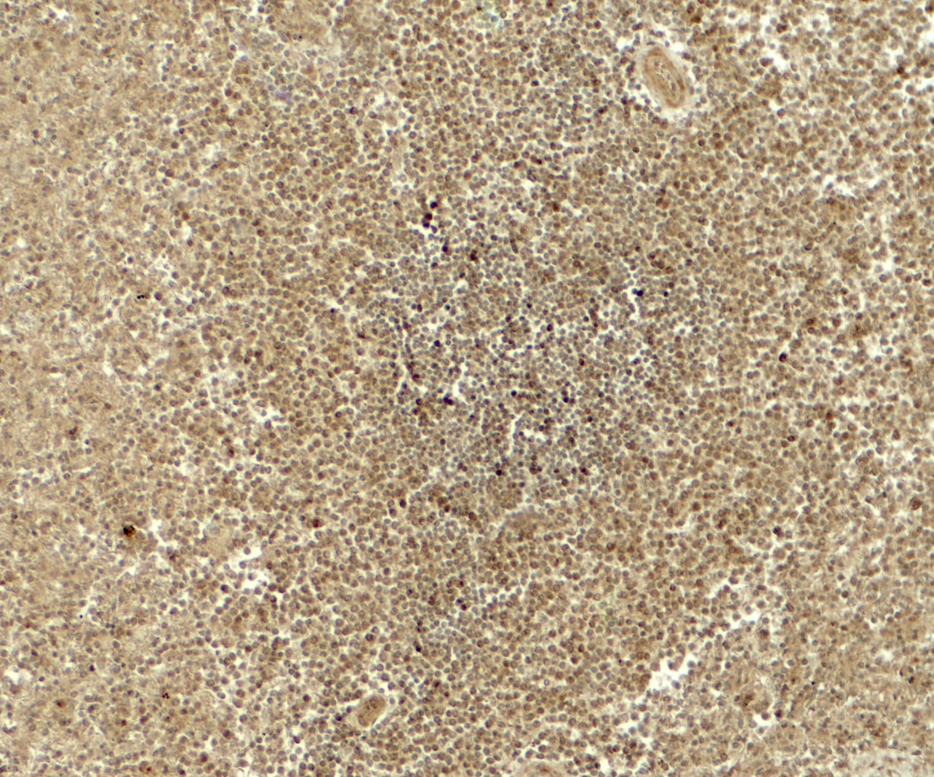 Immunohistochemistry: ATG4B Antibody - BSA Free [NBP2-41307] - Immunohistochemistry of ATG4B in human spleen tissue with ATG4B antibody at 5 u/ml.