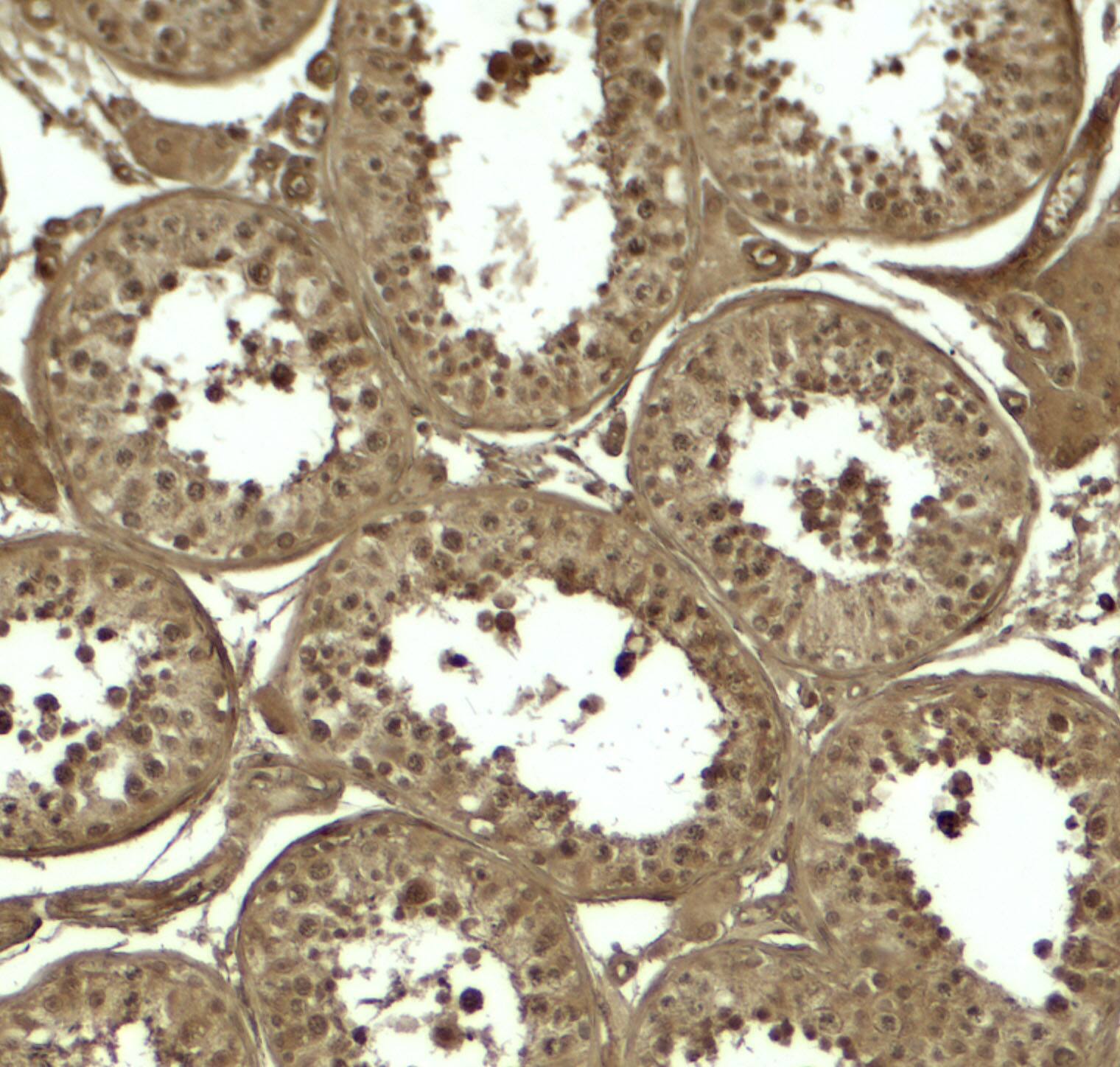 Immunohistochemistry ATG4D Antibody - BSA Free