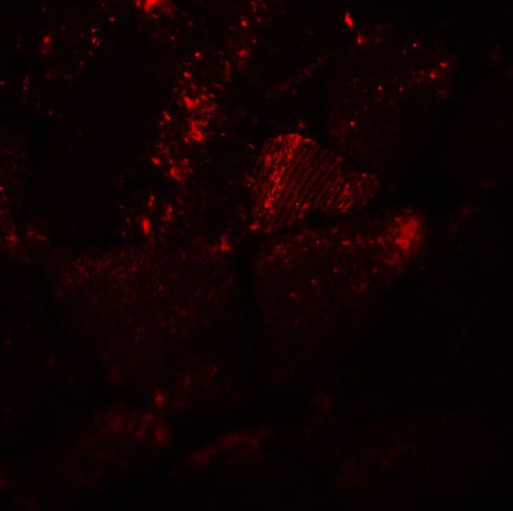 Immunocytochemistry/ Immunofluorescence MYH8 Antibody - BSA Free