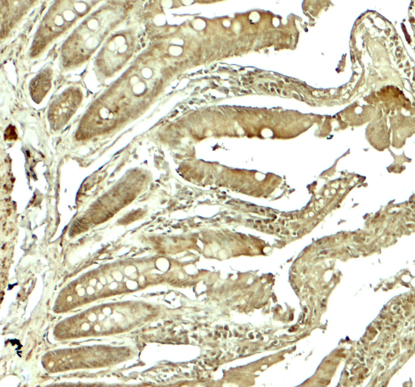 Immunohistochemistry: Adenosine A2b R Antibody - BSA Free [NBP2-41312] - Immunohistochemistry of Adenosine A2b R in rat colon tissue with Adenosine A2b R antibody at 5 u/mL.