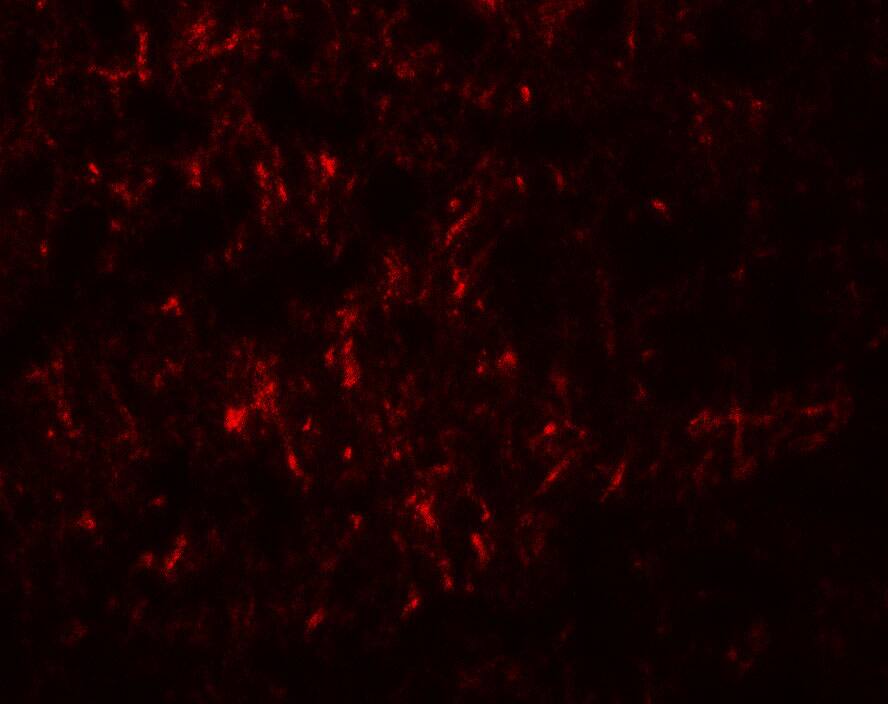 Immunocytochemistry/ Immunofluorescence: SLC29A4 Antibody - BSA Free [NBP2-41314] - Immunofluorescence of SLC29A4 in human brain tissue with SLC29A4 antibody at 20 u/mL.