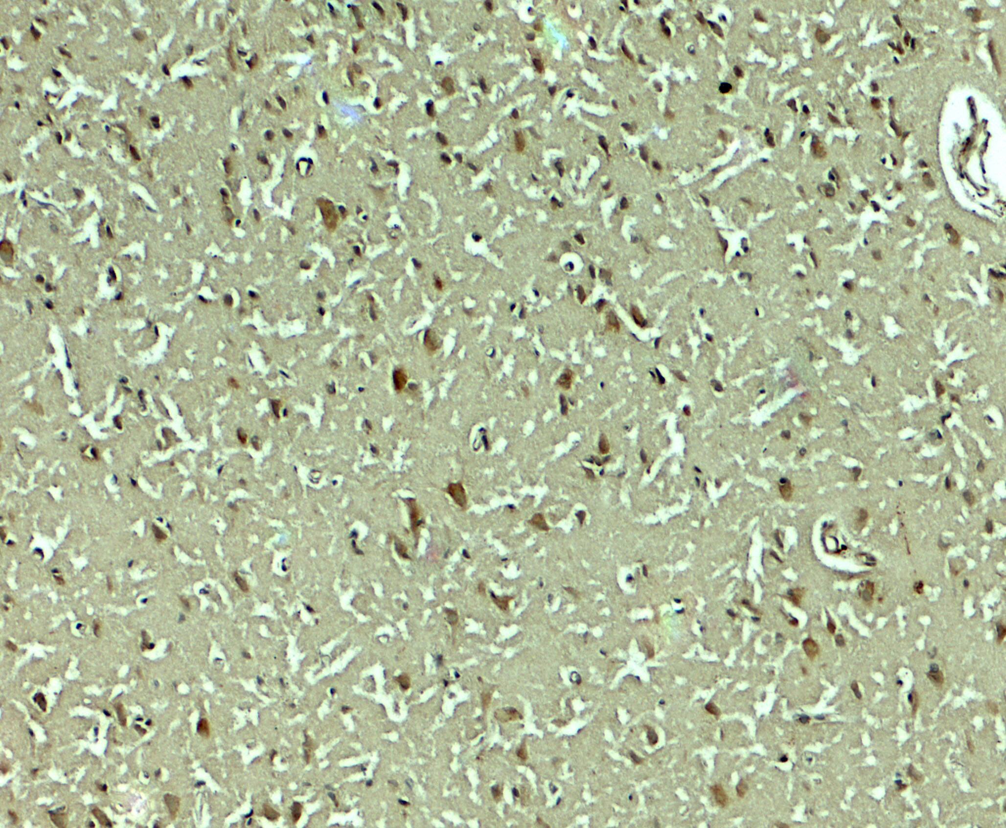 Immunohistochemistry: SLC29A4 Antibody - BSA Free [NBP2-41314] - Immunohistochemistry of SLC29A4 in human brain tissue with SLC29A4 antibody at 5 u/mL.