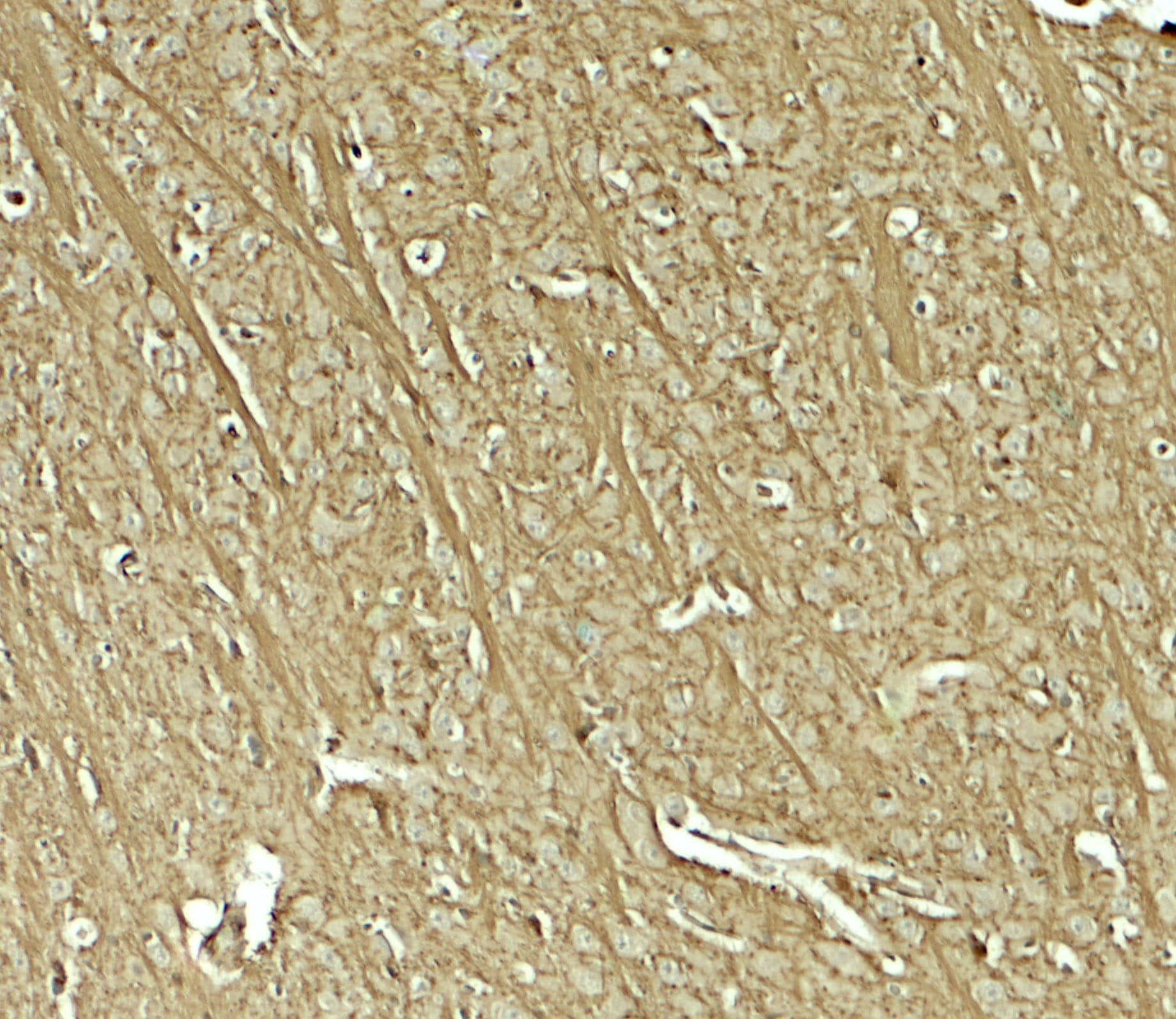 Immunohistochemistry Teneurin-1 Antibody - BSA Free