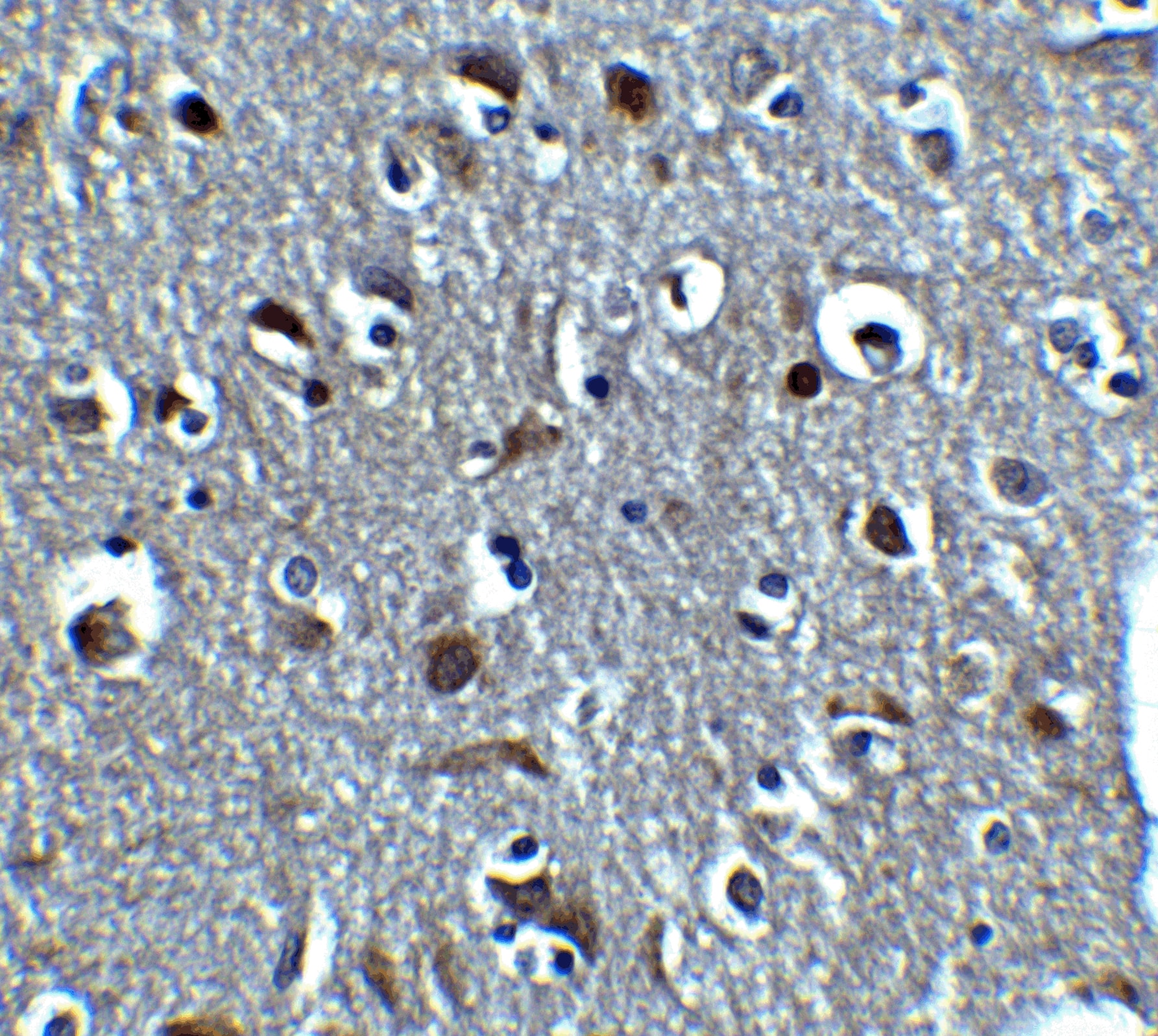 Immunohistochemistry: Relaxin-3 Antibody - BSA Free [NBP2-41317] - Immunohistochemistry of Relaxin-3 in human brain tissue with Relaxin-3 antibody at 5 ug/mL.